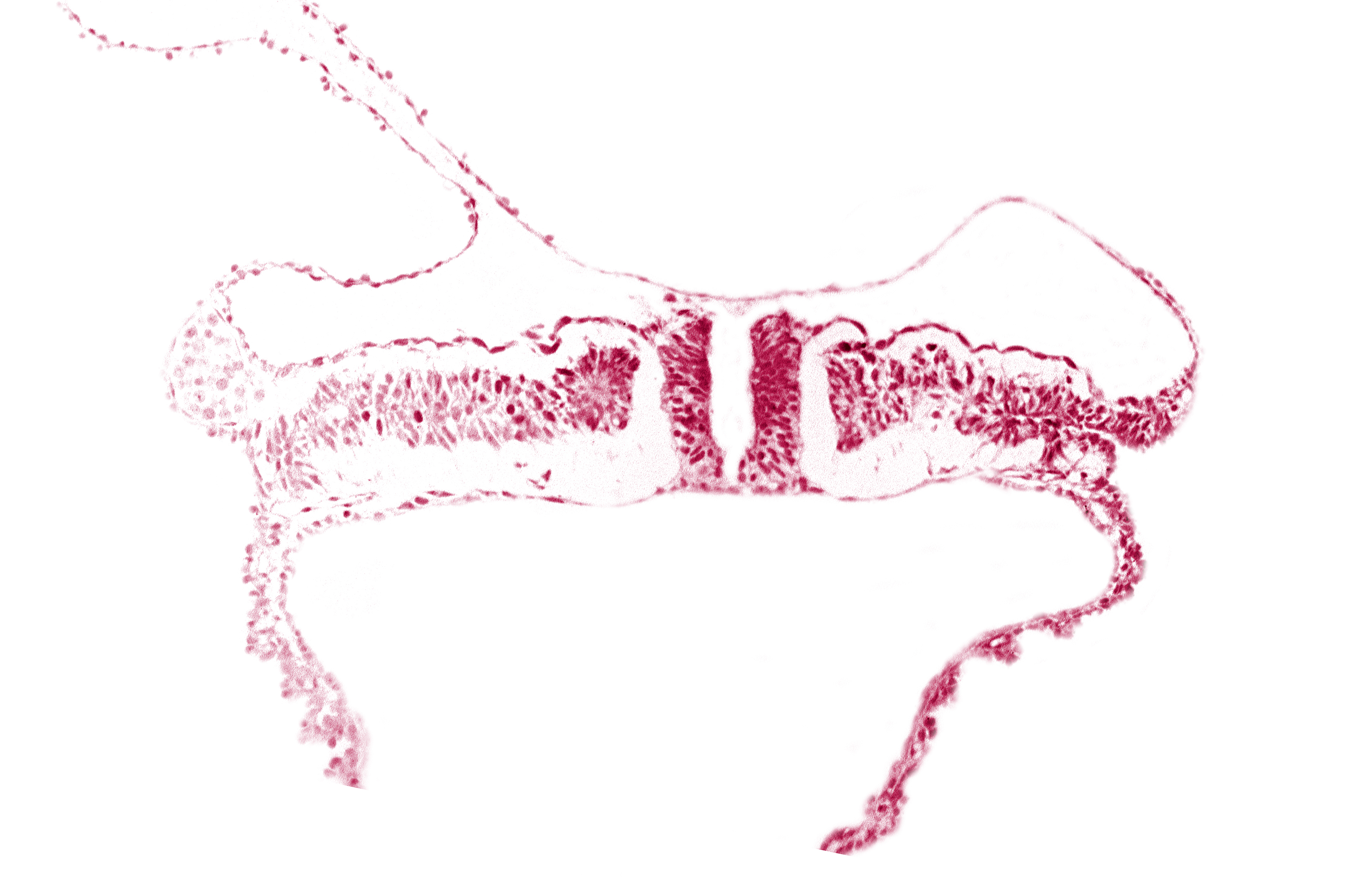 caudal neuropore, intermediate mesenchyme, lateral plate mesoderm, paraxial mesoderm, umbilical vesicle wall endoderm, umbilical vesicle wall mesoderm