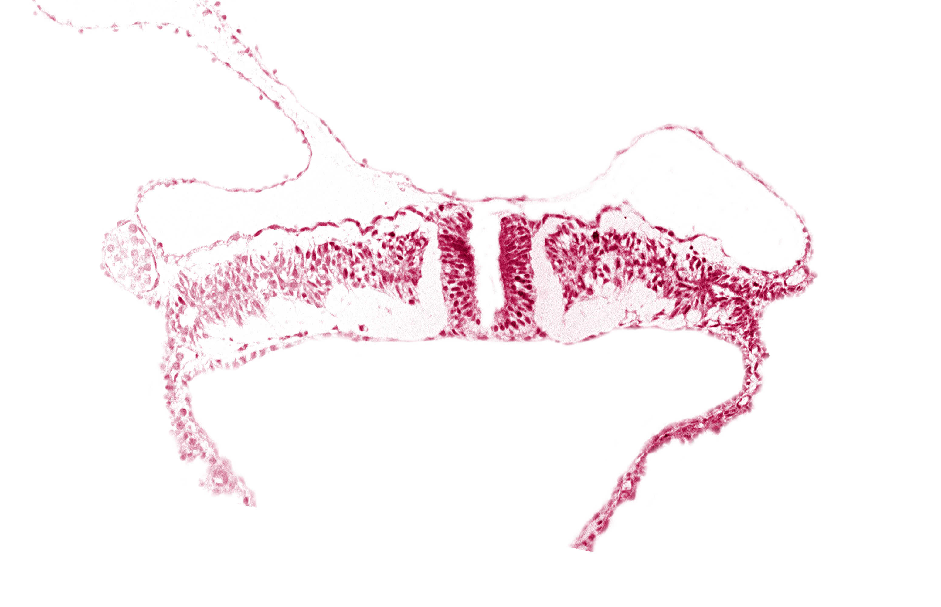 dorsal aorta, embryonic endoderm, embryonic surface ectoderm, extra-embryonic coelom, extra-embryonic ectoderm, extra-embryonic endoderm, extra-embryonic mesoderm, intermediate mesenchyme, lateral plate mesoderm, paraxial mesoderm, primordial peritoneal cavity