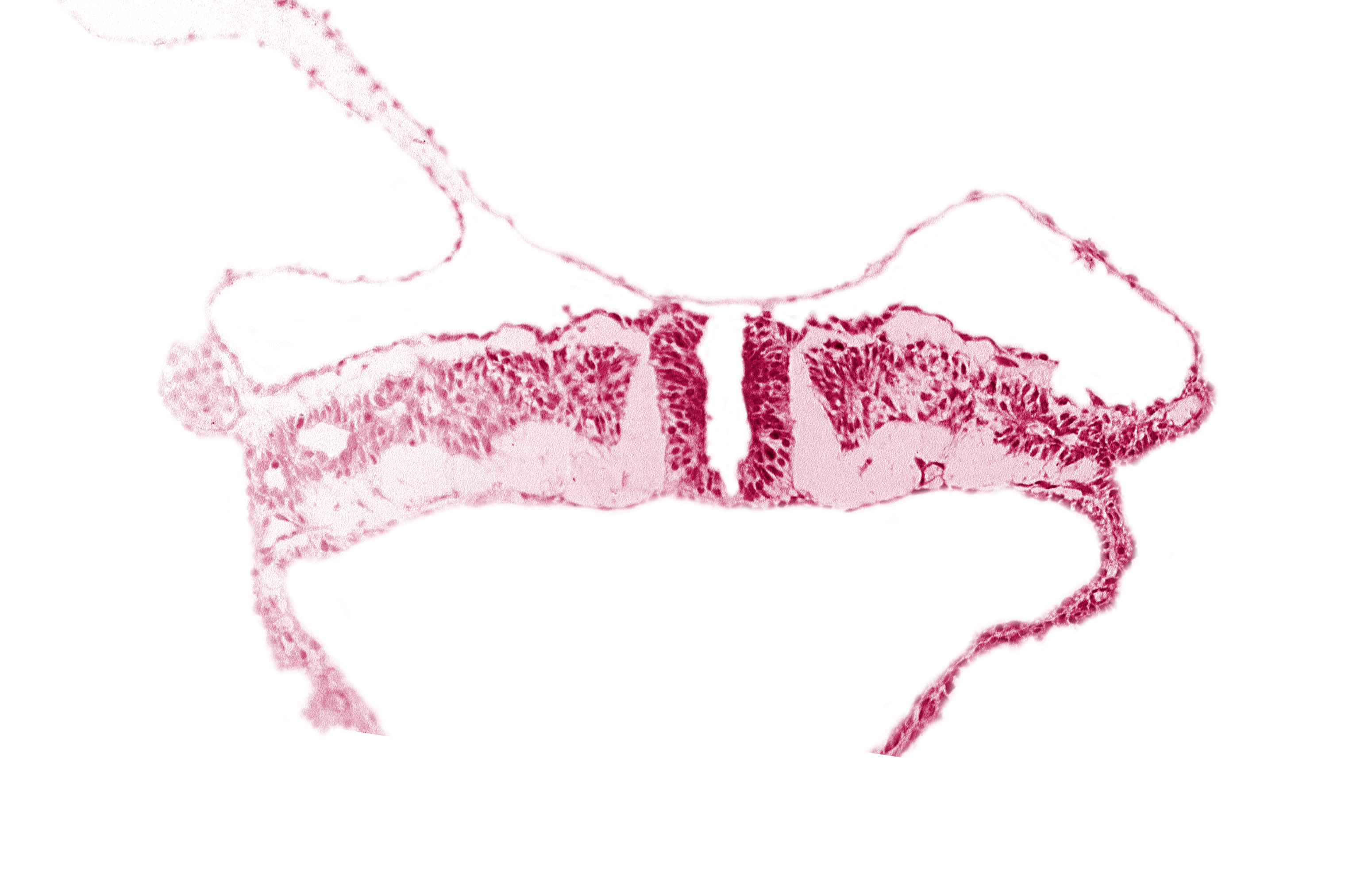 amnion attachment, amniotic cavity, dorsal aorta, neural fold, umbilical vesicle cavity, umbilical vesicle wall
