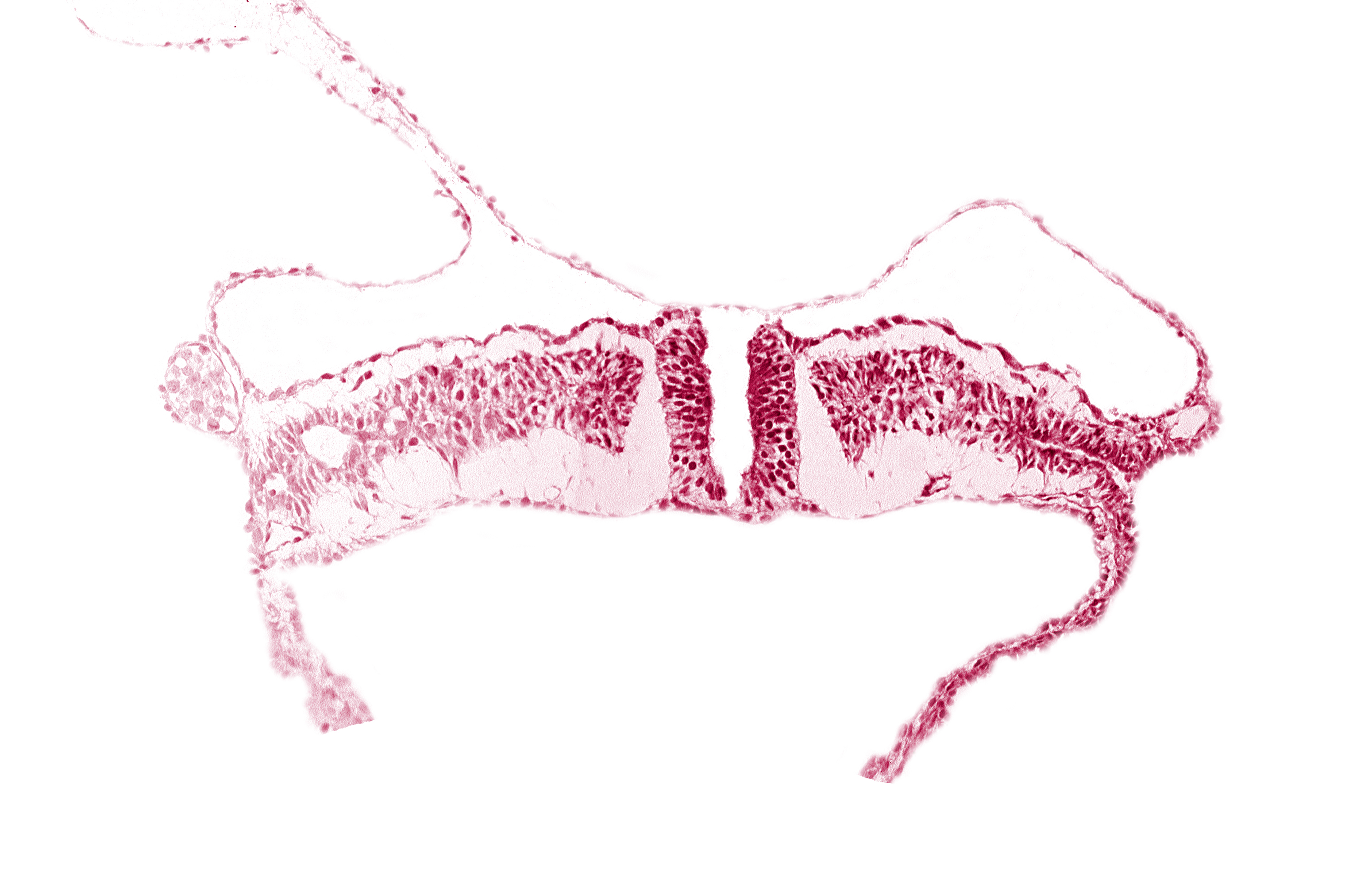 caudal neuropore, dorsal aorta