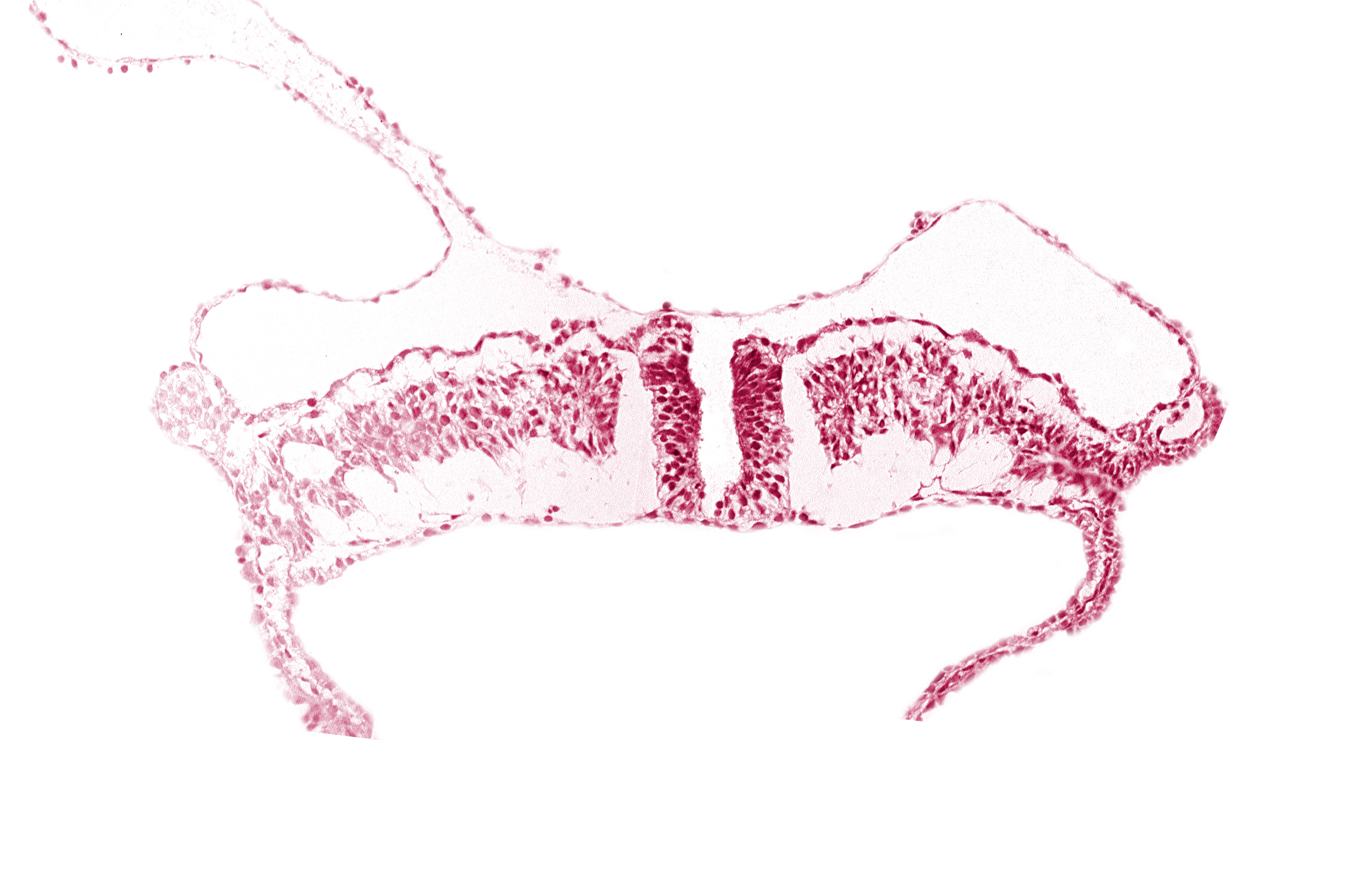 amniotic cavity, caudal neuropore, midgut, umbilical vesicle cavity