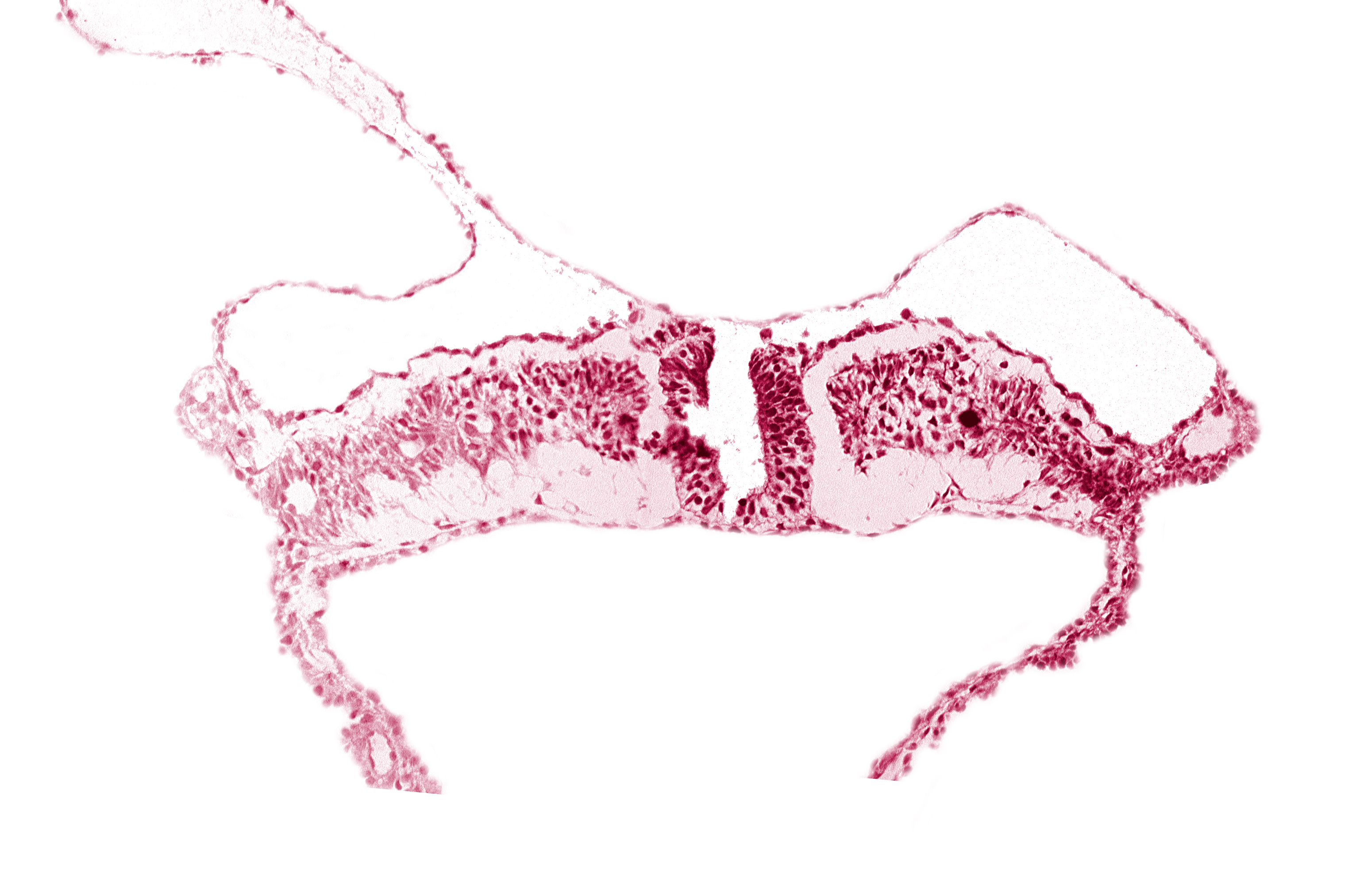 caudal neuropore, endoderm, intermediate mesenchyme, lateral plate mesoderm, paraxial mesoderm, surface ectoderm