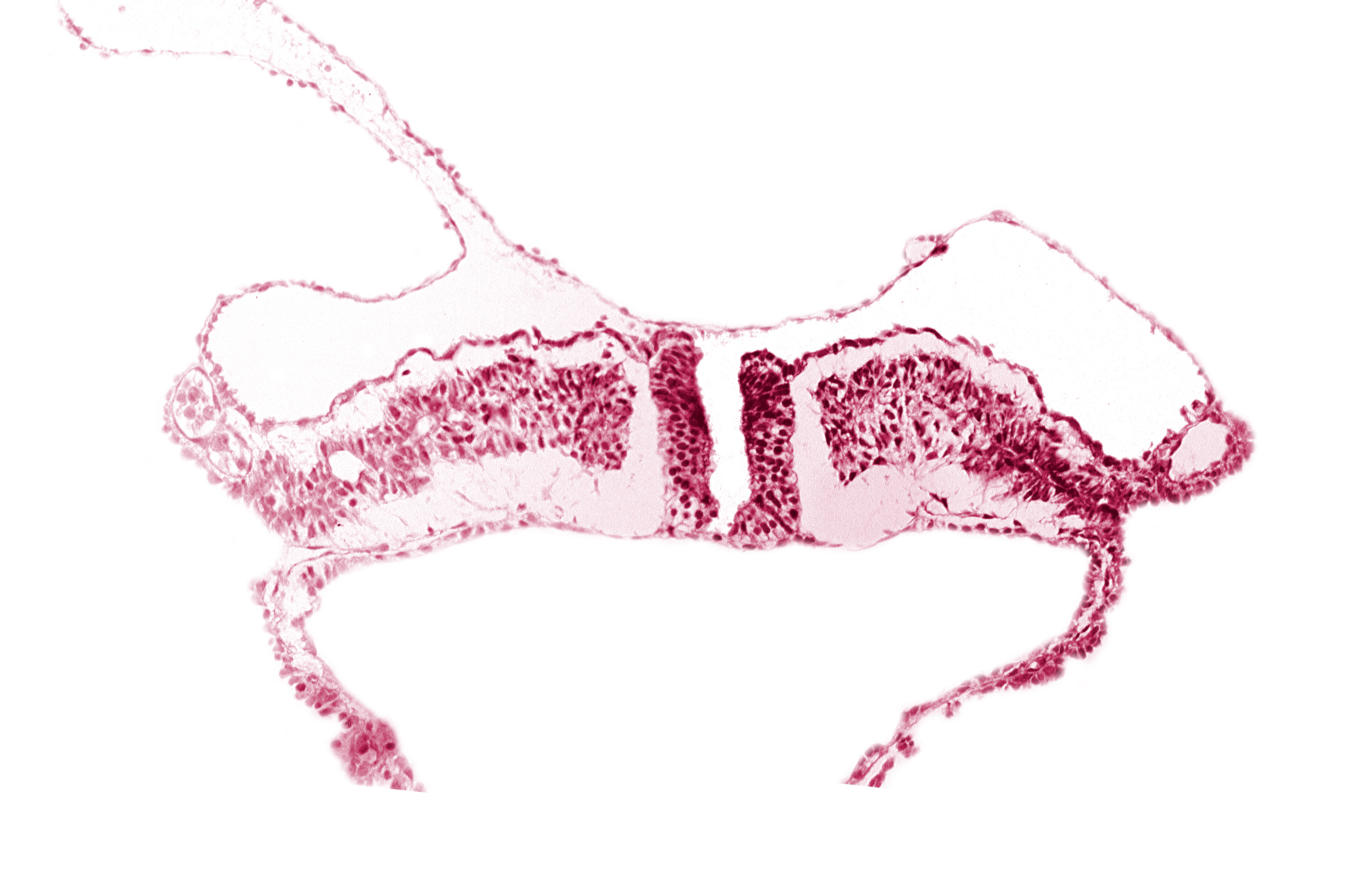 endoderm, intermediate mesenchyme, paraxial mesoderm, primordial peritoneal cavity, somatopleuric mesoderm, splanchnopleuric mesoderm, surface ectoderm