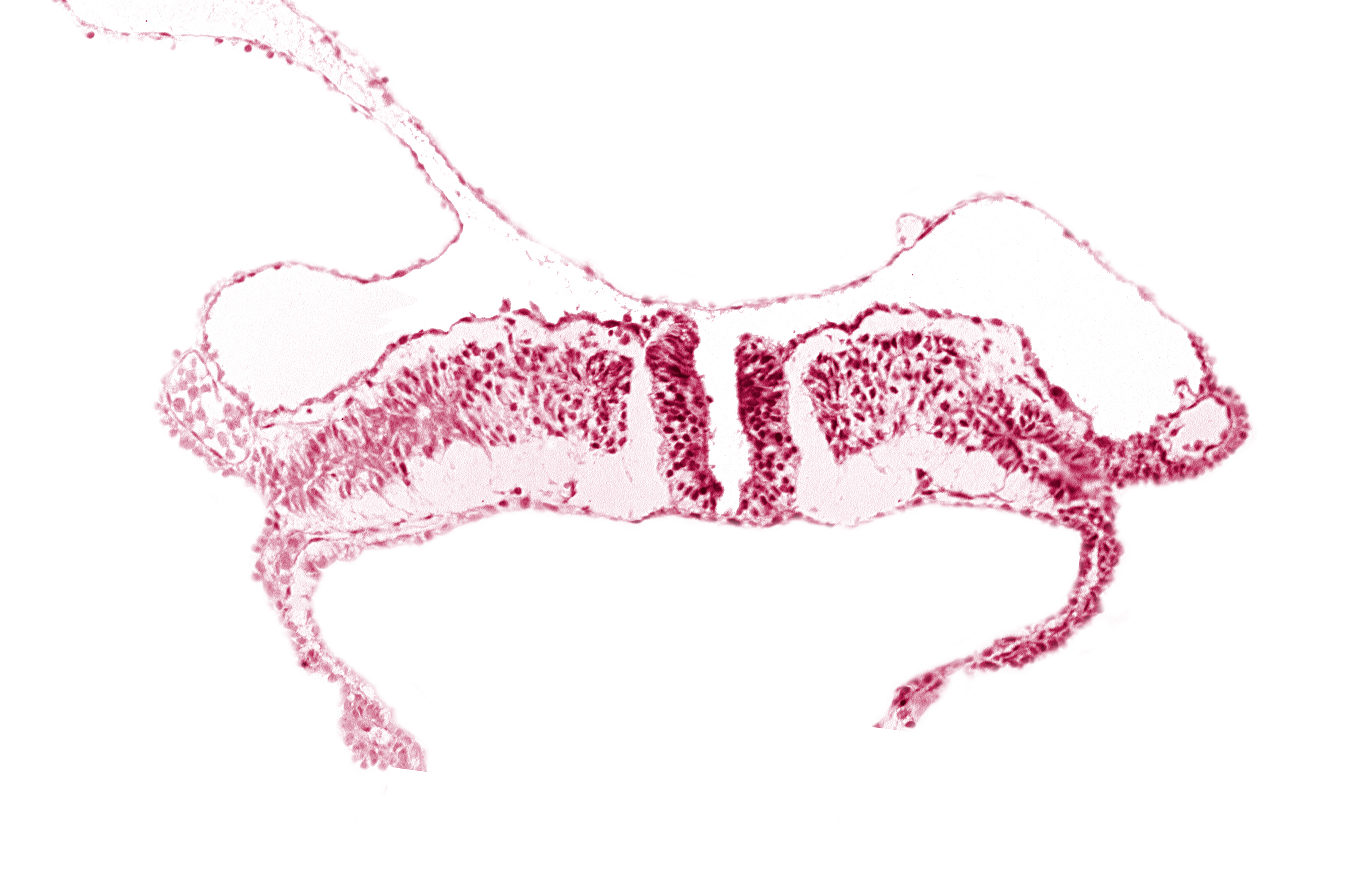 endoderm, intermediate mesenchyme, paraxial mesoderm, splanchnopleuric mesoderm, surface ectoderm