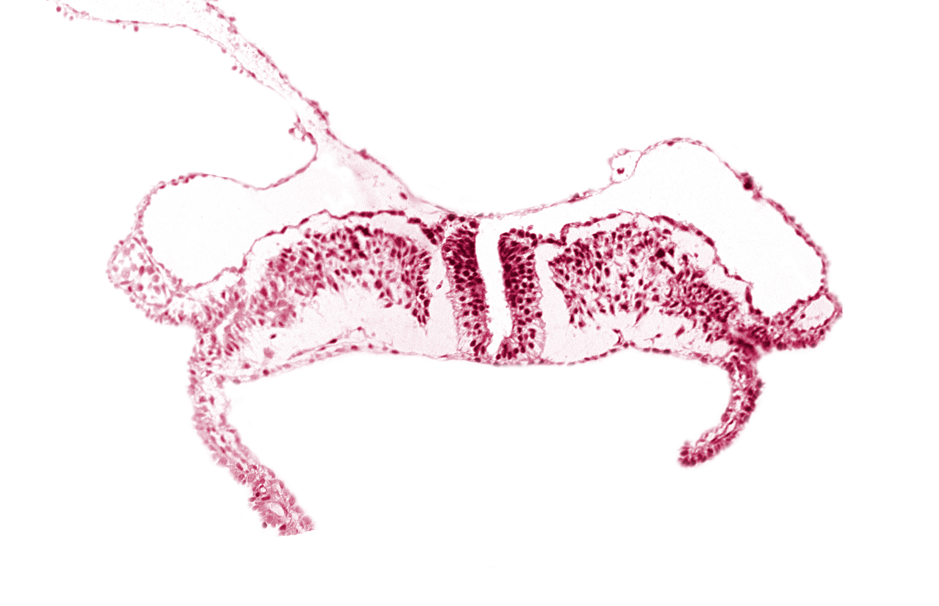 amniotic cavity, caudal neuropore, communication between primordial peritoneal cavity and extra-embryonic coelom, dorsal aorta plexus, umbilical vesicle cavity