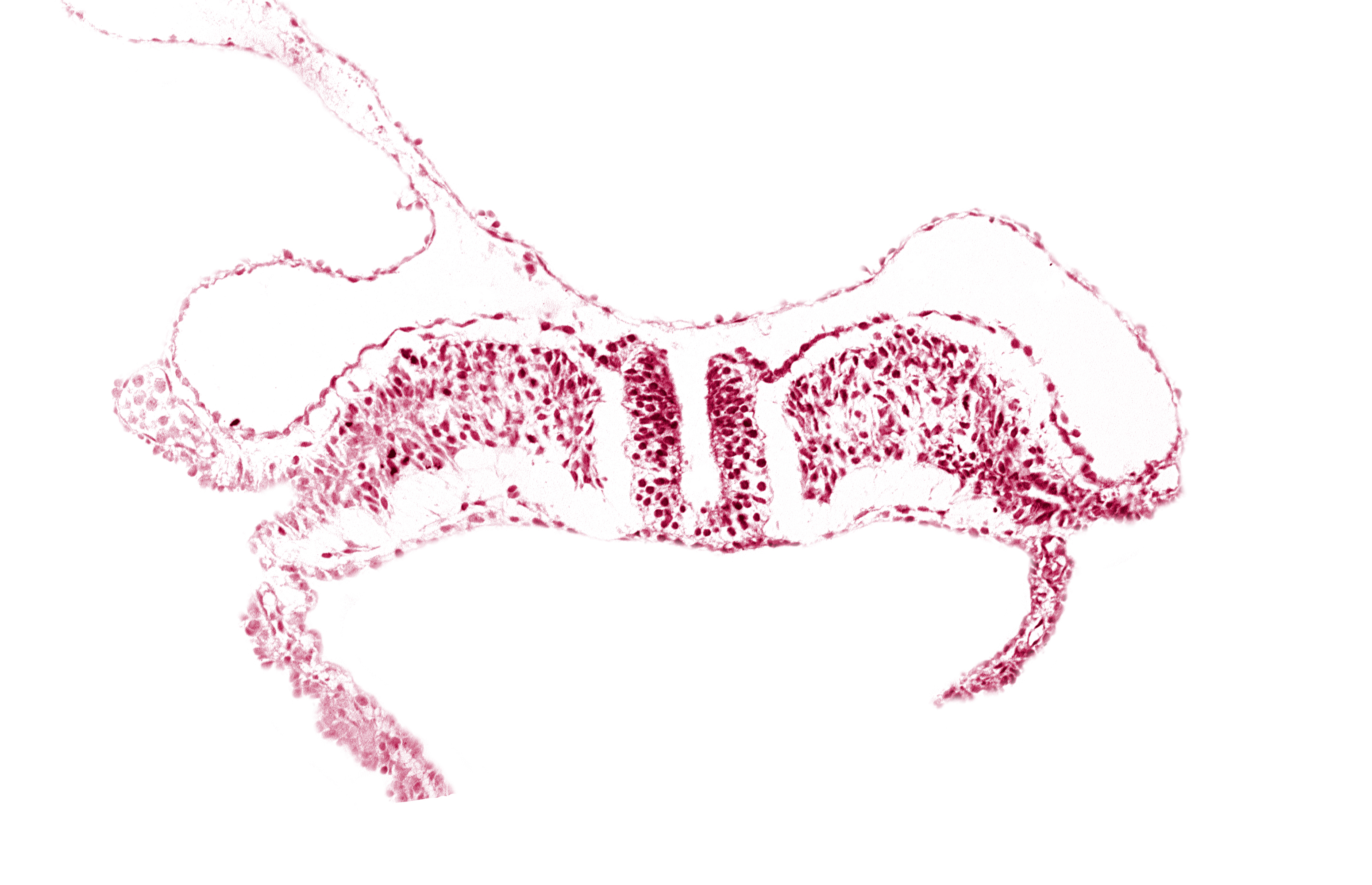 amniotic cavity, caudal neuropore, communication between primordial peritoneal cavity and extra-embryonic coelom, dorsal aorta plexus, umbilical vesicle cavity