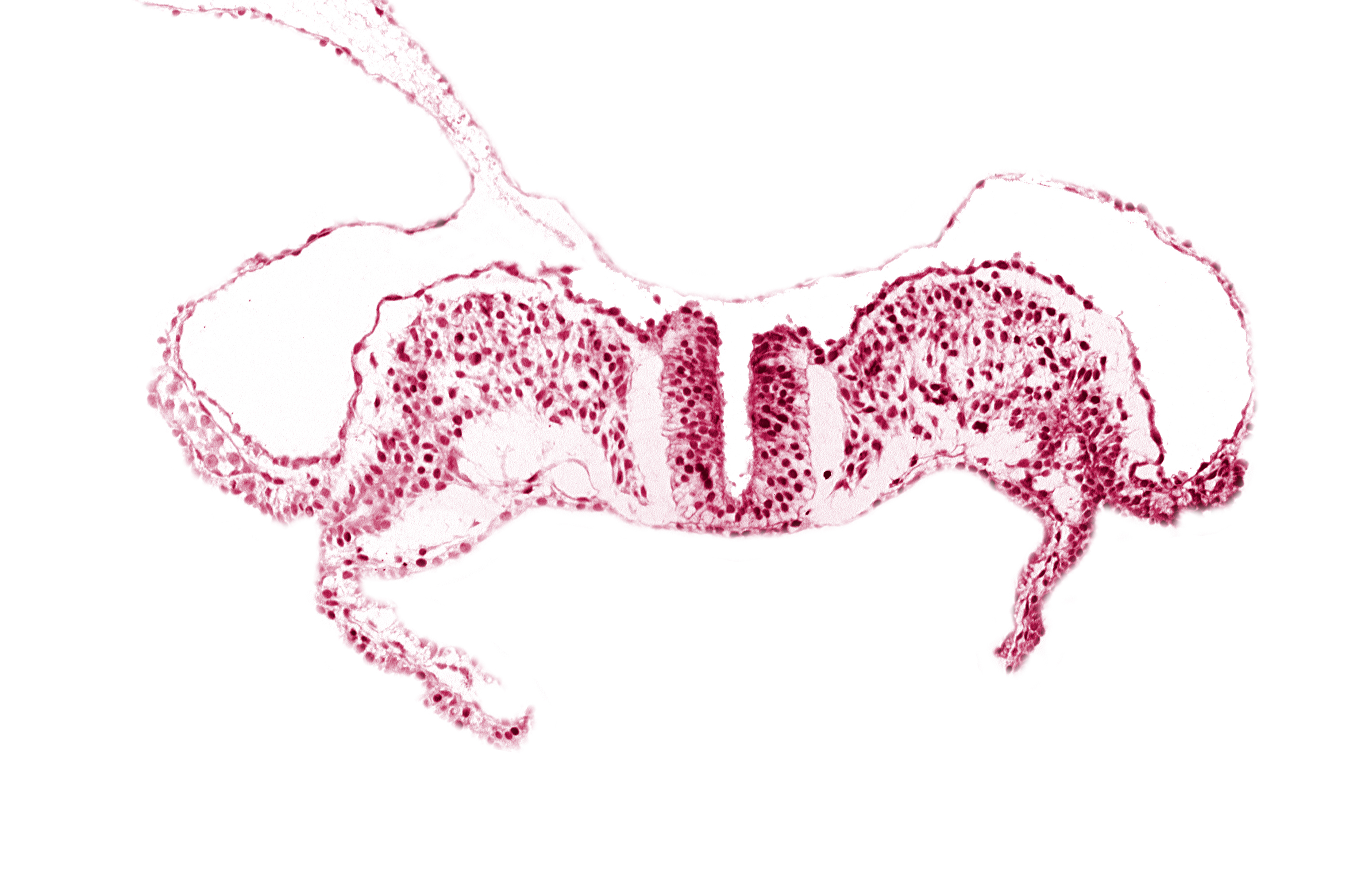 amnion ectoderm, amnion mesoderm, caudal neuropore, dorsal aorta plexus, extra-embryonic coelom, primordial lateral body fold, primordial peritoneal cavity