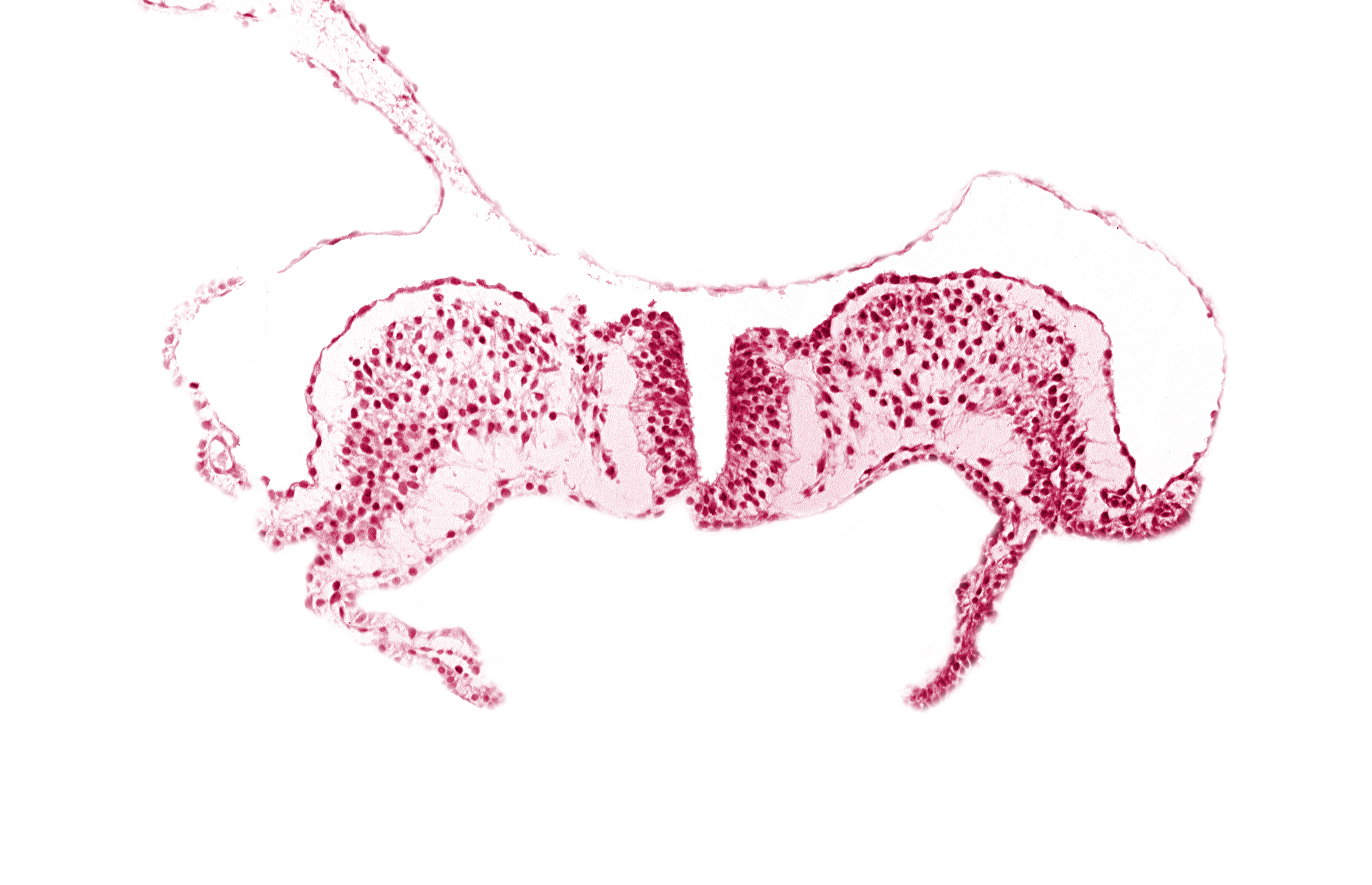 caudal neuropore, communication between primordial peritoneal cavity and extra-embryonic coelom, primordial lateral body fold