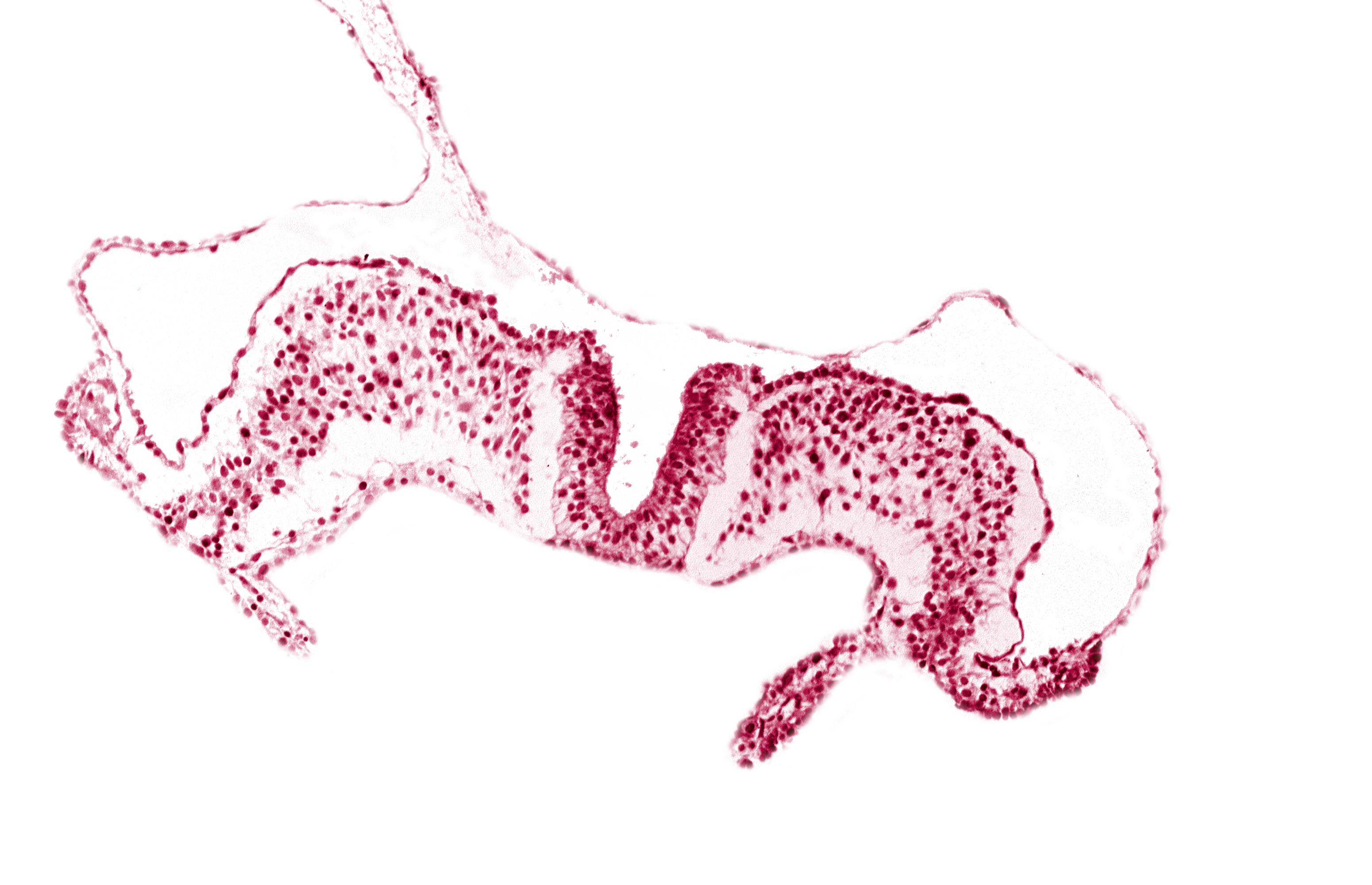 amnion attachment, amniotic cavity, caudal neuropore, primordial lateral body fold