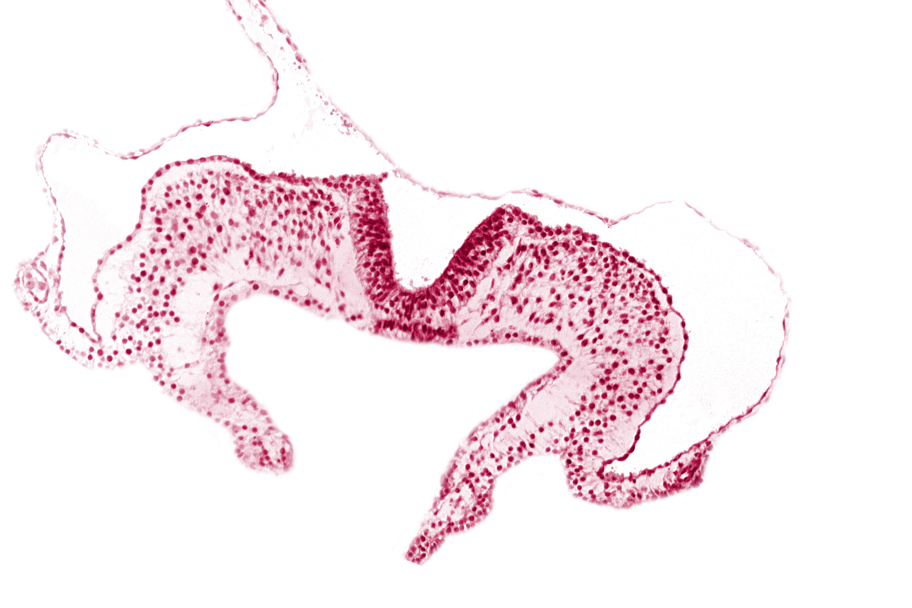 endoderm, mesoderm, midgut, neural fold, neural groove, notochordal plate, primordial lateral body fold, surface ectoderm