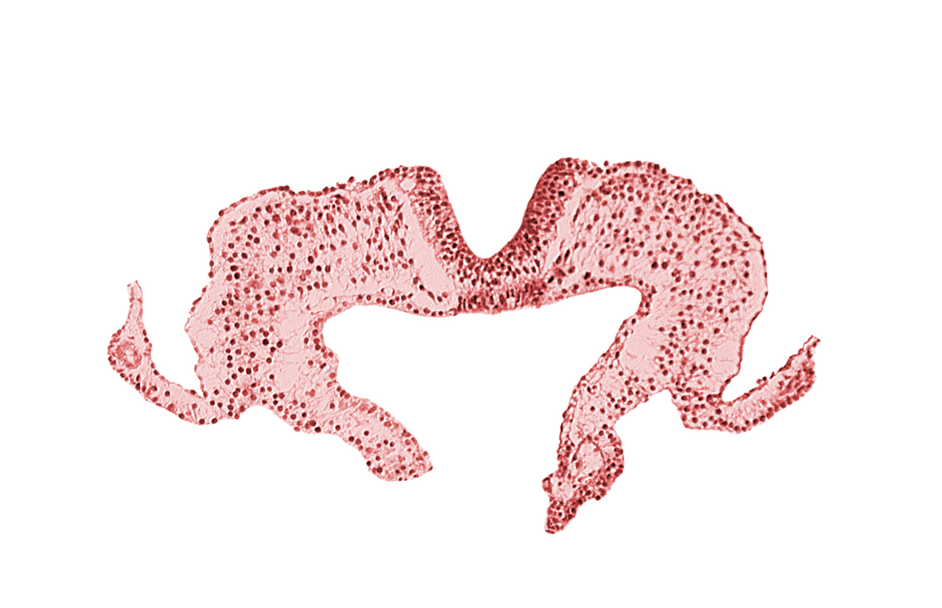 caudal part of notochordal plate, mesoderm, neural fold, neural groove, primordial lateral body fold, surface ectoderm