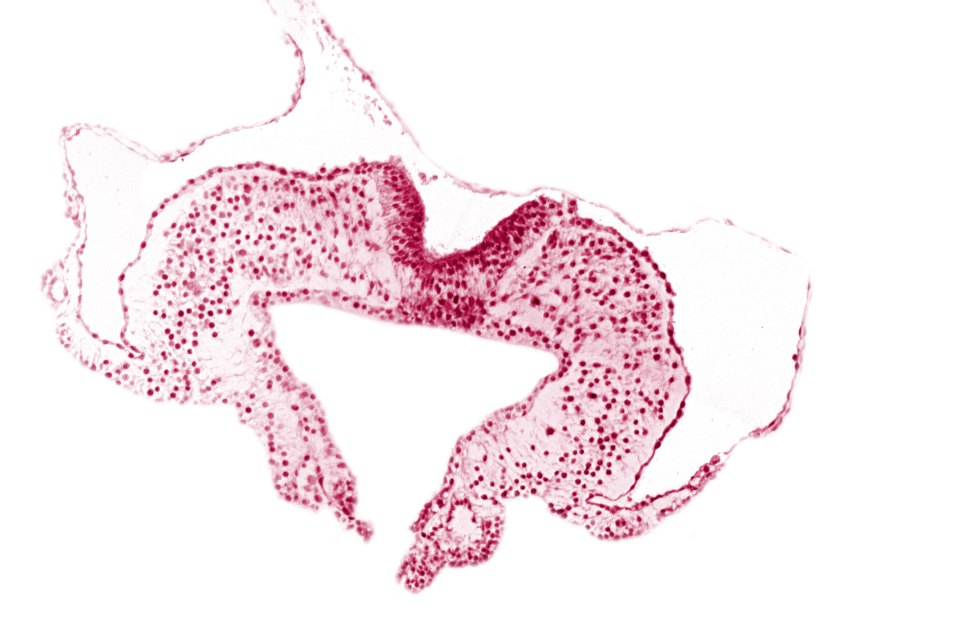 mesoderm, midgut, neural fold, neural groove, primordial lateral body fold, surface ectoderm