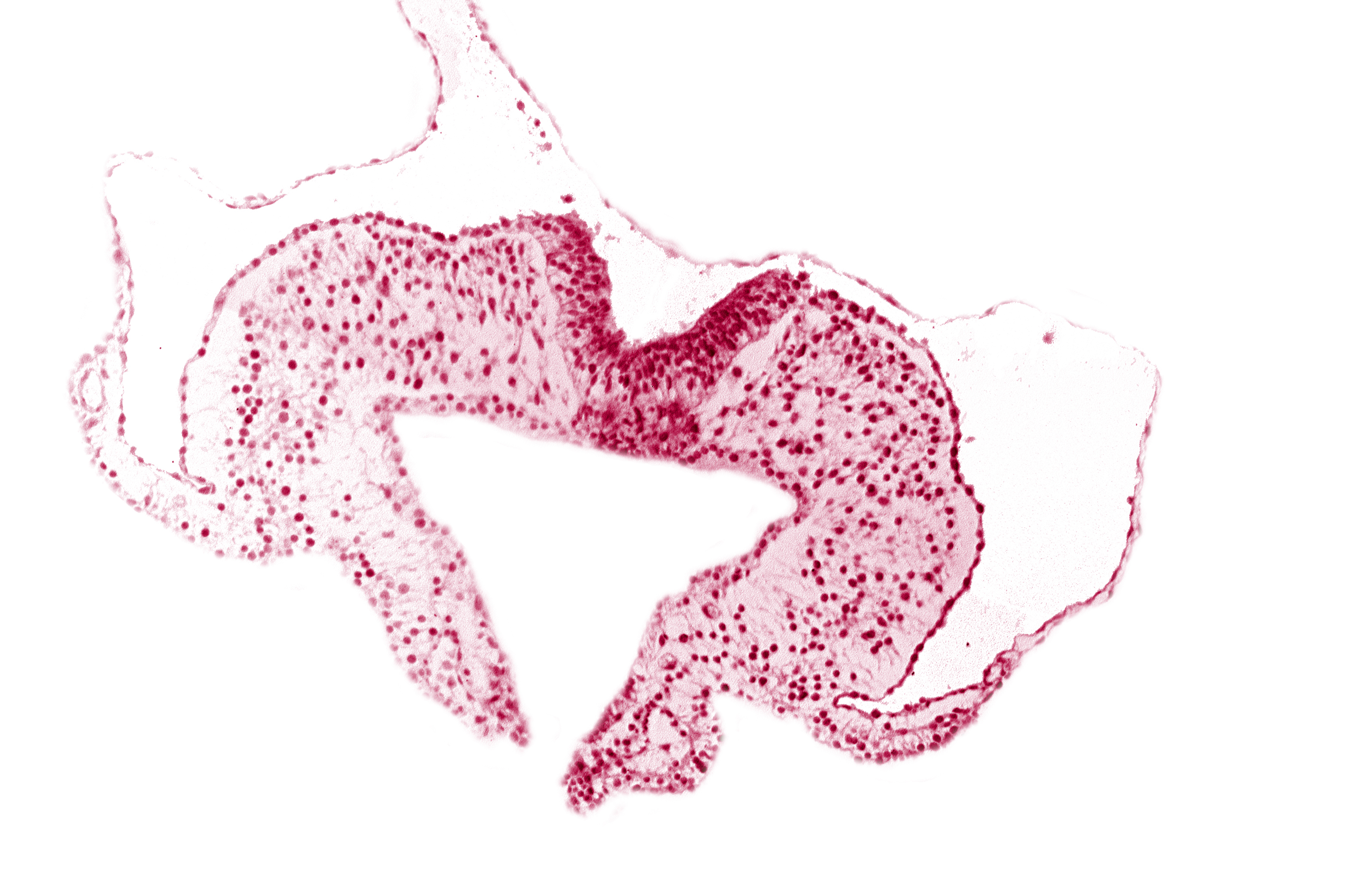 midgut, neural fold, neural groove, primordial lateral body fold, surface ectoderm