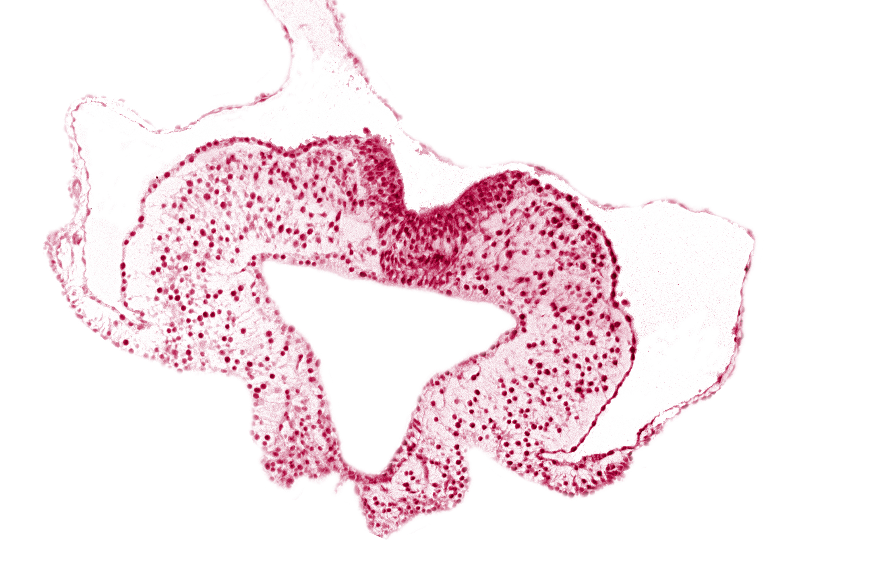 caudal intestinal portal, endoderm, transition region between notochordal plate and gastrulation streak