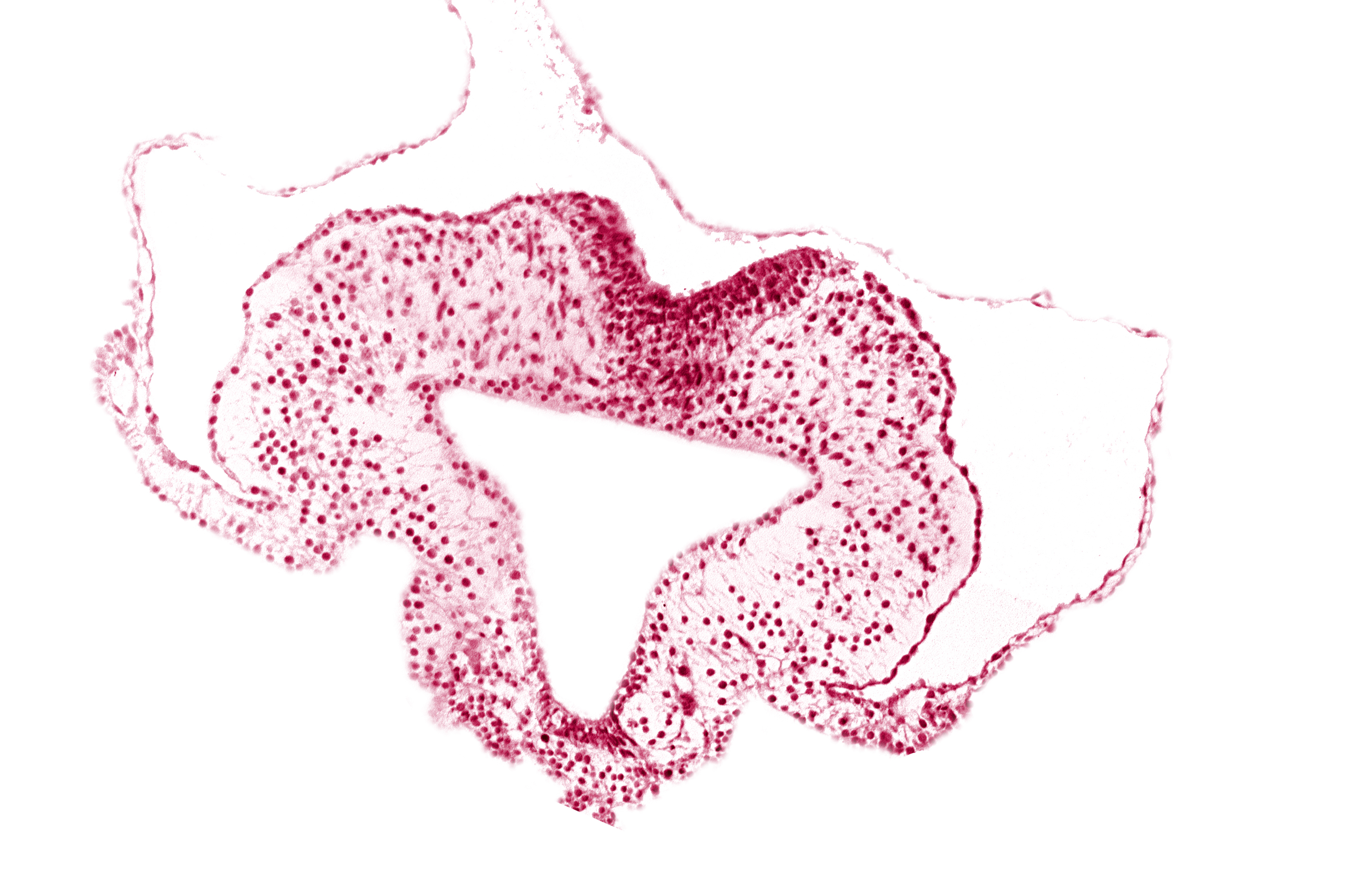 allantoic primordium, amnion attachment, amniotic cavity, extra-embryonic coelom, gastrulation (primitive) streak, hindgut, left umbilical vein, neural plate, primordial lateral body fold