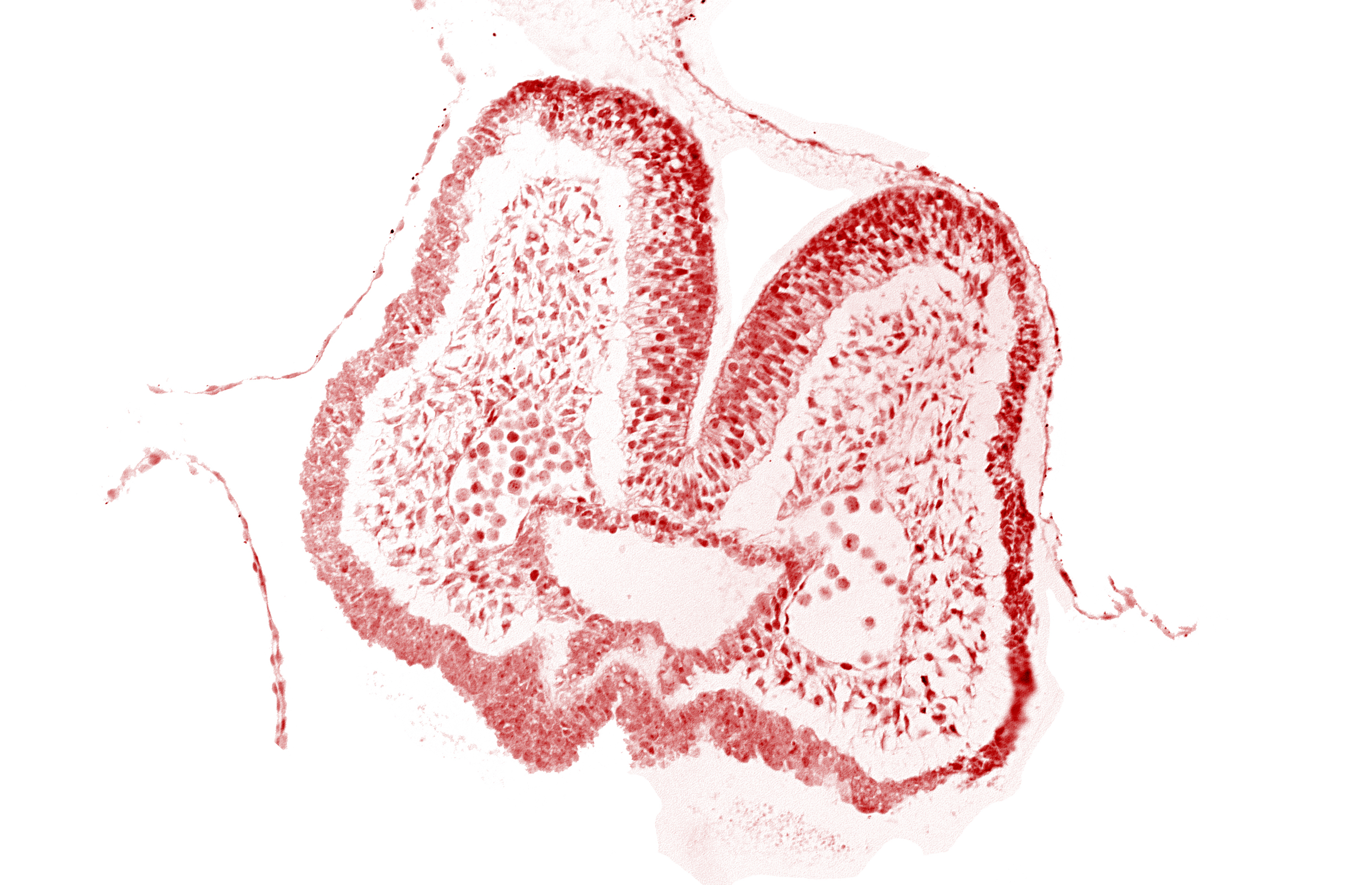 aortic arch 1, artifact space(s), endoderm, foregut, mandibular prominence of pharyngeal arch 1, mesencephalic neural crest, mesenchyme in pharyngeal arch 1, neural fold [mesencephalon (M)], neural groove, nucleated blood cells, prechordal plate (oropharyngeal membrane), stomodeum, surface ectoderm