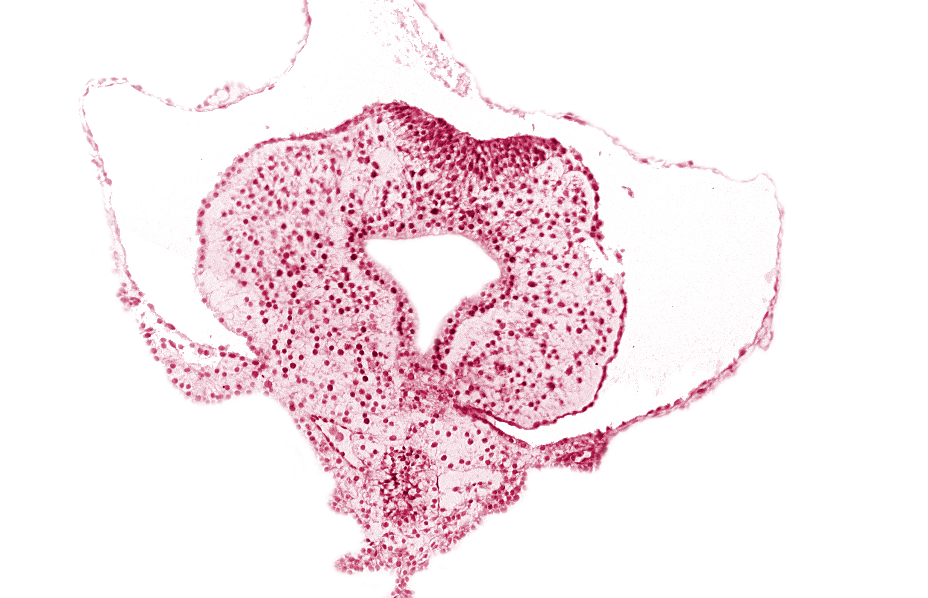 allantoic primordium, amnion attachment, body stalk, caudal eminence, cloacal membrane, gastrulation (primitive) streak, hindgut, junction of amnion and tail fold, left umbilical vein, neural plate, tail fold region