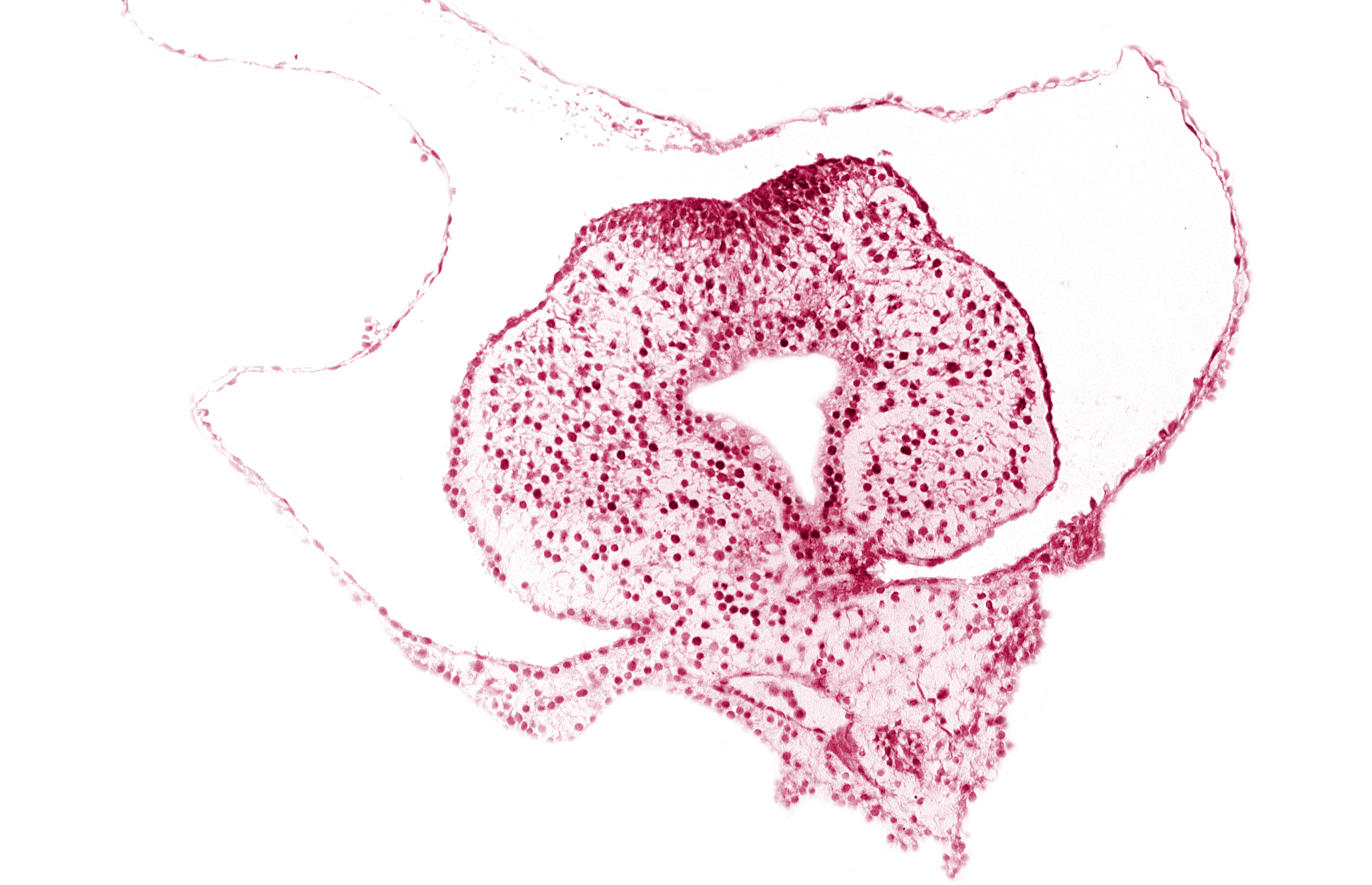 allantoic primordium, amnion attachment, caudal eminence, caudal part of hindgut lumen, left umbilical vein, neural plate, right umbilical vein, tail fold region