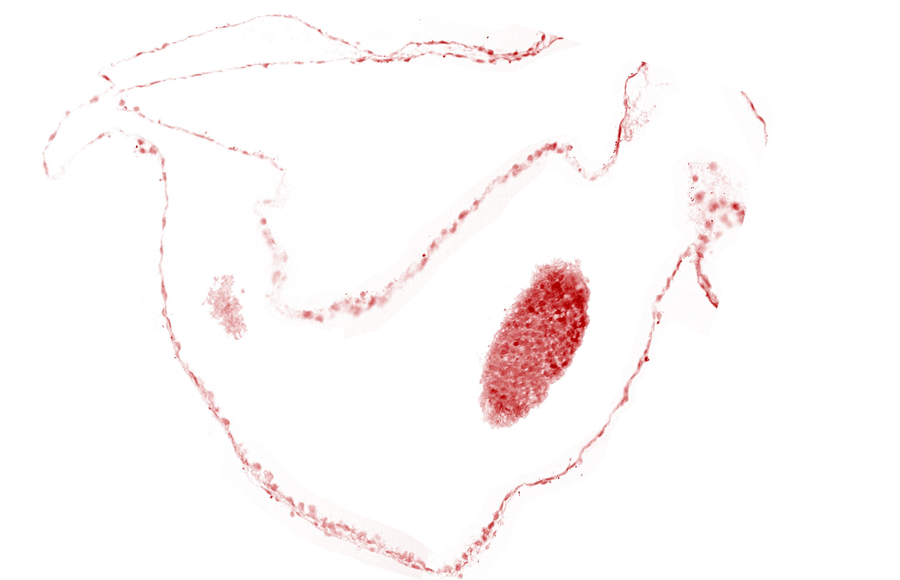 cephalic part of left neural fold (primordial diencephalon)