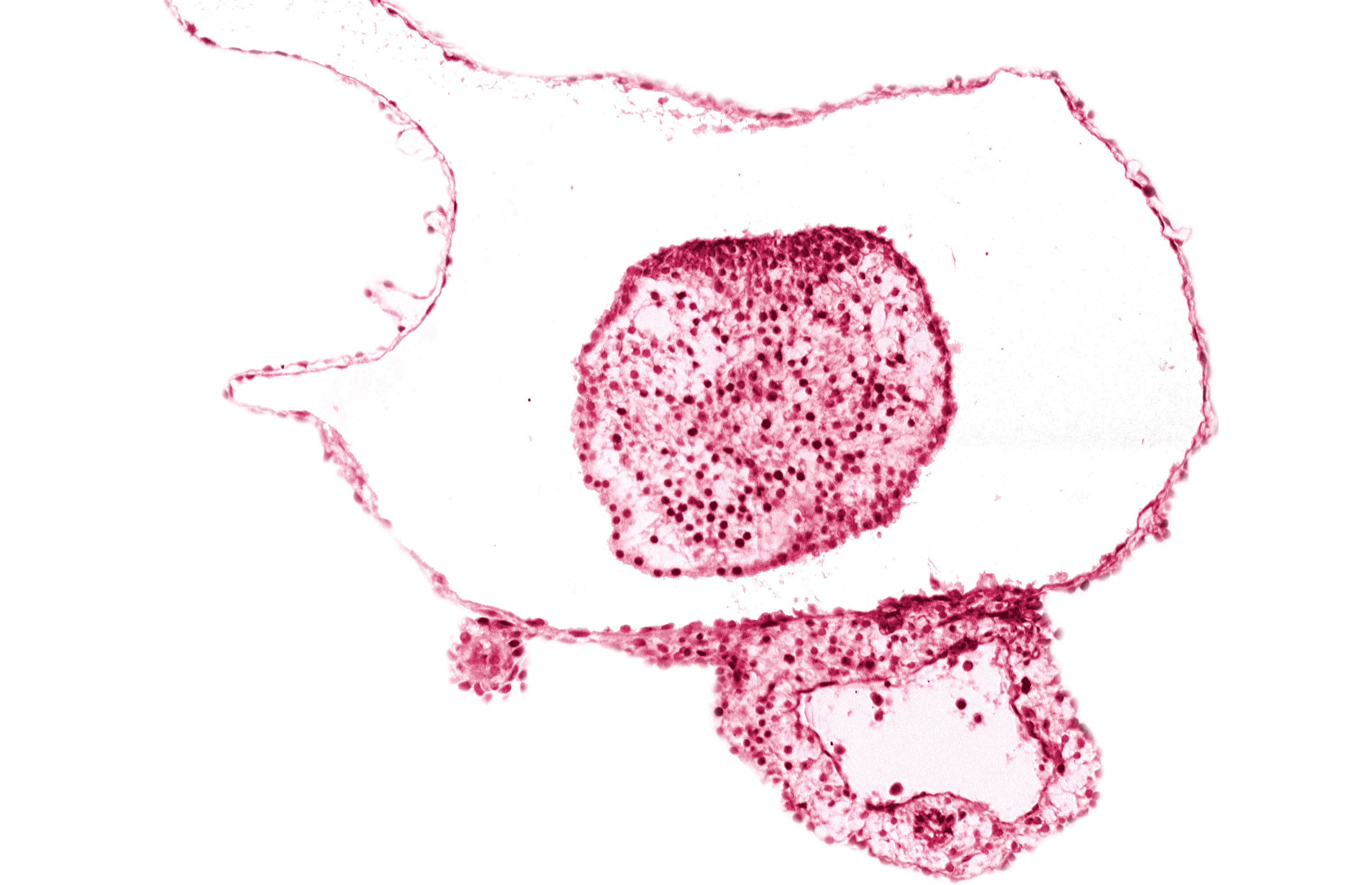 caudal eminence, gastrulation (primitive) streak, neural ectoderm, surface ectoderm of caudal eminence