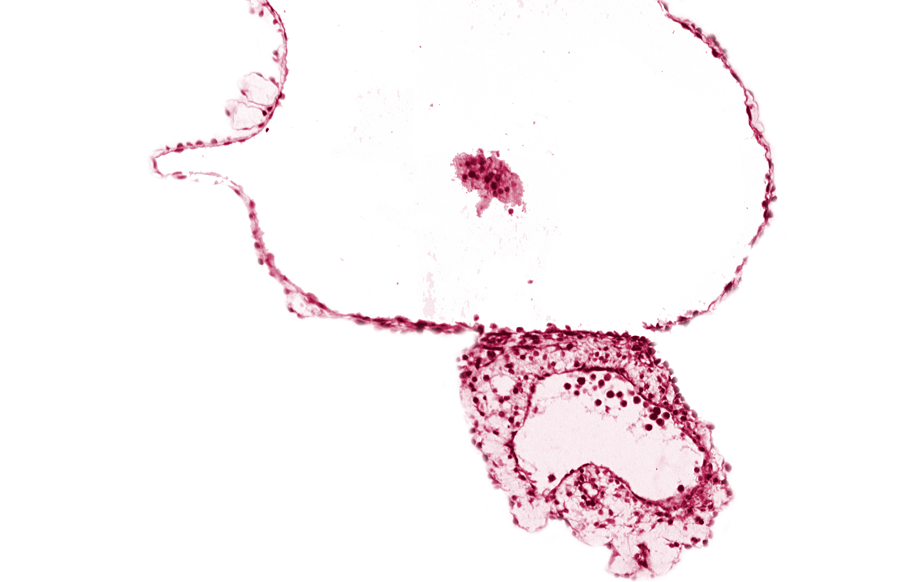 caudal edge of caudal eminence