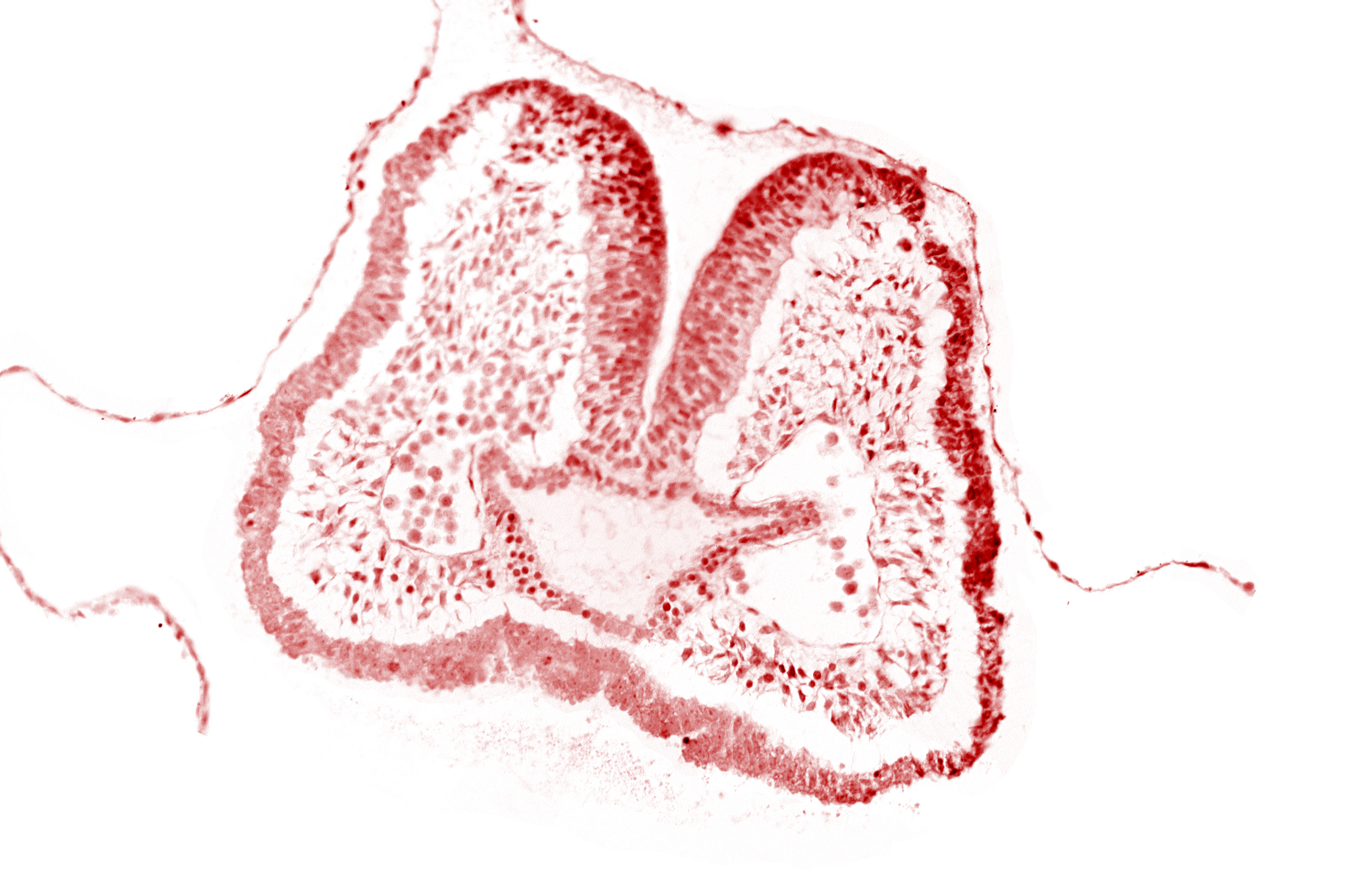 aortic arch 1, cephalic part of pharyngeal pouch 1, facio-vestibulocochlear neural crest (CN VII and CN VIII), foregut, mandibular prominence of pharyngeal arch 1, neural fold [rhombencephalon (Rh. A)], neural groove, notochordal plate, stomodeum