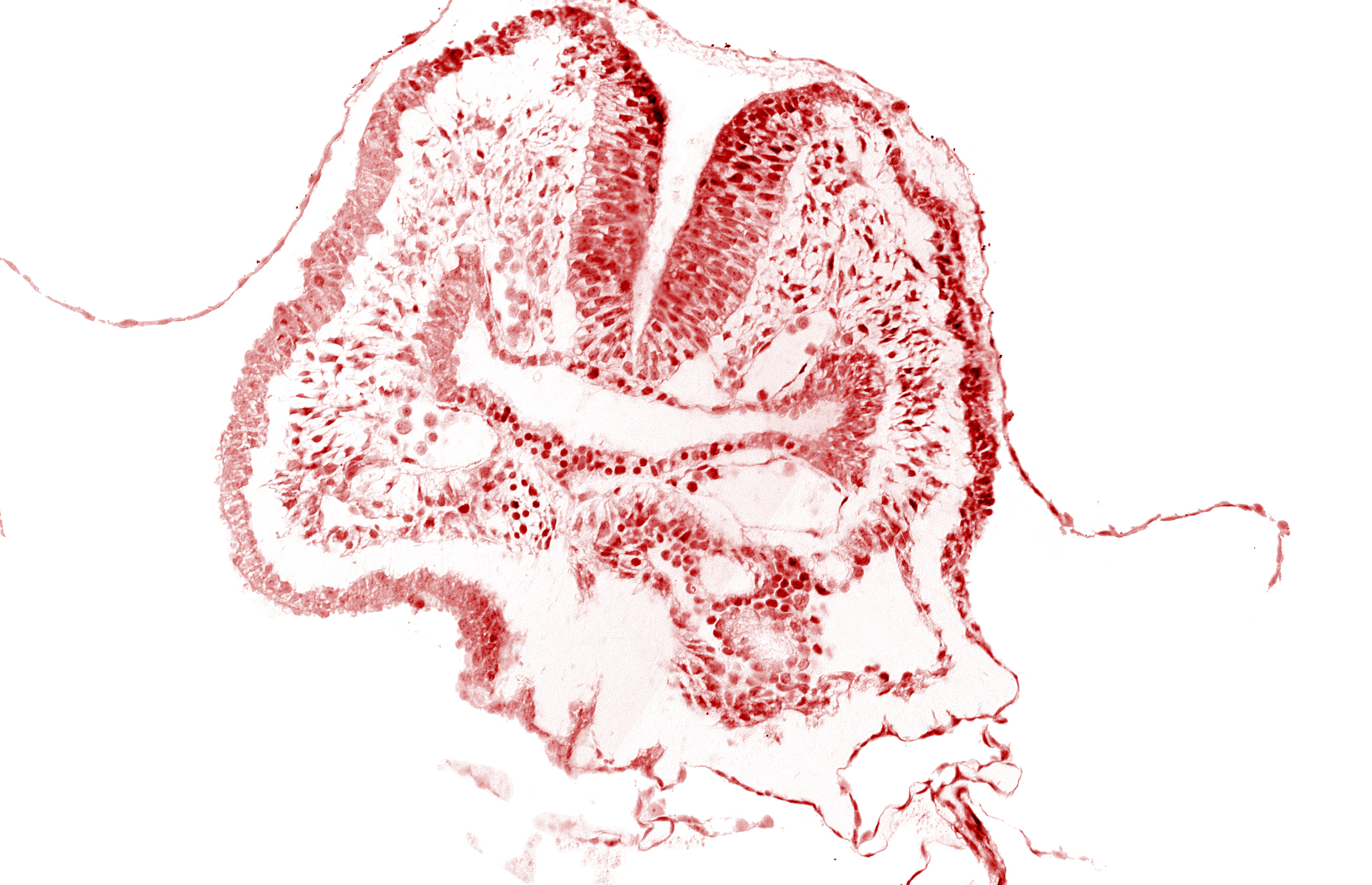 amnion, amnion attachment, aortic arch 1, cephalic neuropore, dorsal aorta, endoderm, facio-vestibulocochlear neural crest (CN VII and CN VIII), floor of foregut, head fold region, neural fold [rhombencephalon (Rh. A)], pericardial cavity, pharyngeal pouch 1, surface ectoderm