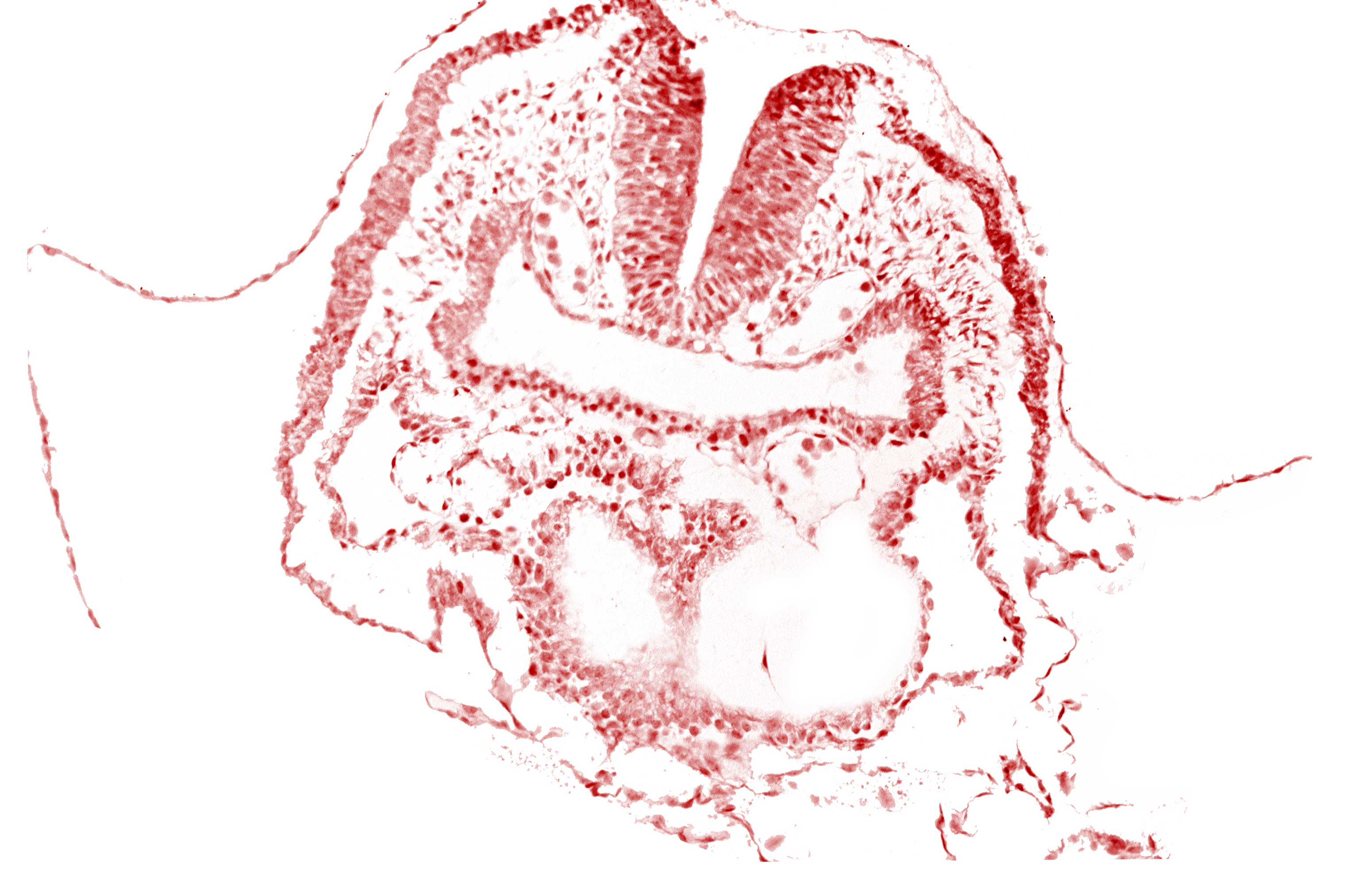 amnion, aortic arch 1, dorsal aorta, head fold region, neural fold [rhombencephalon (Rh. A)], pericardial cavity, pharyngeal pouch 1