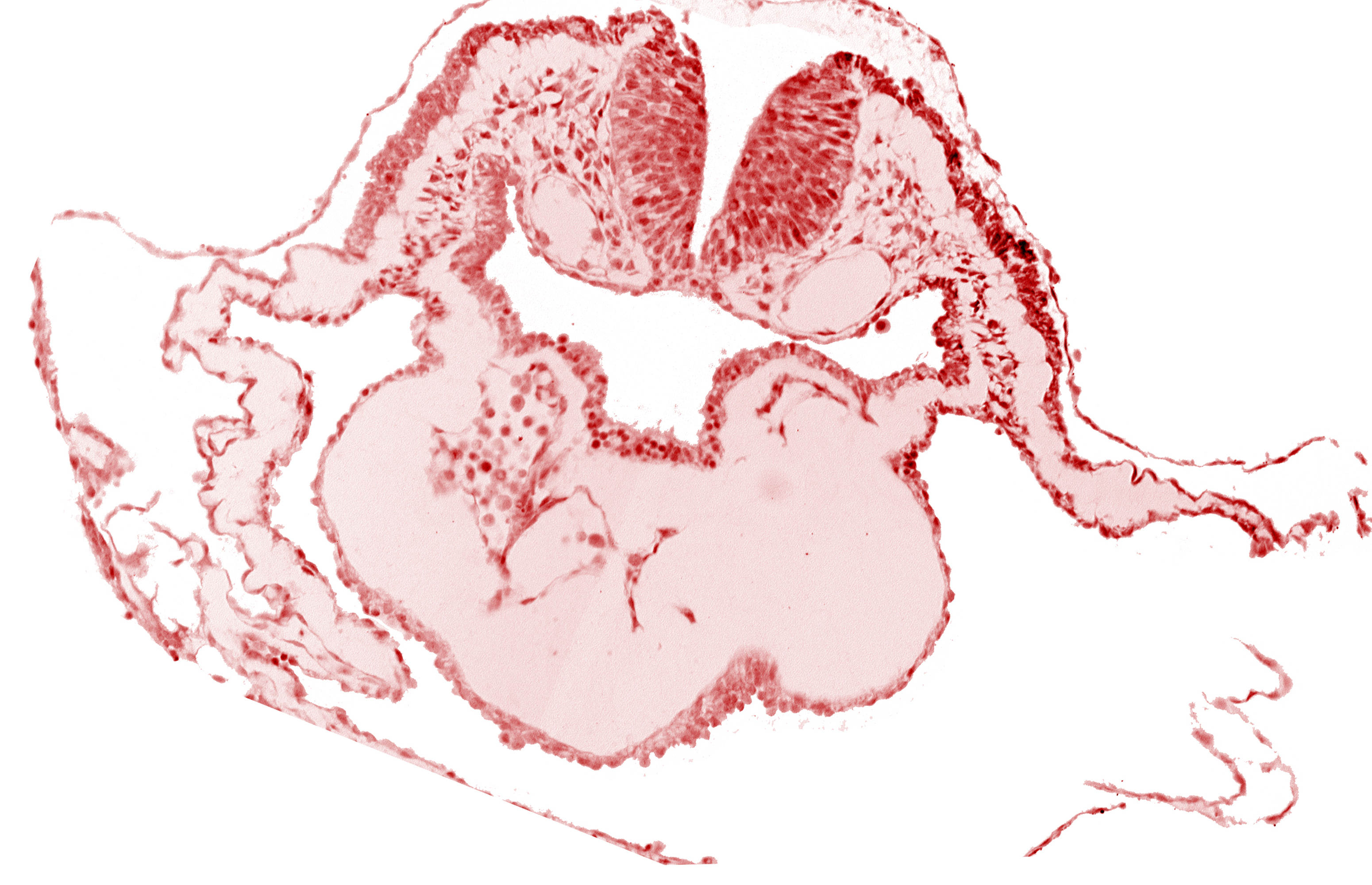 artifact separation(s), bulbis cordis, caudal edge of aortic arch 1, dorsal aorta, epimyocardium, lateral pharyngeal recess, left bulboventricular sulcus, looped heart, neural fold [rhombencephalon (Rh. B)], notochordal plate