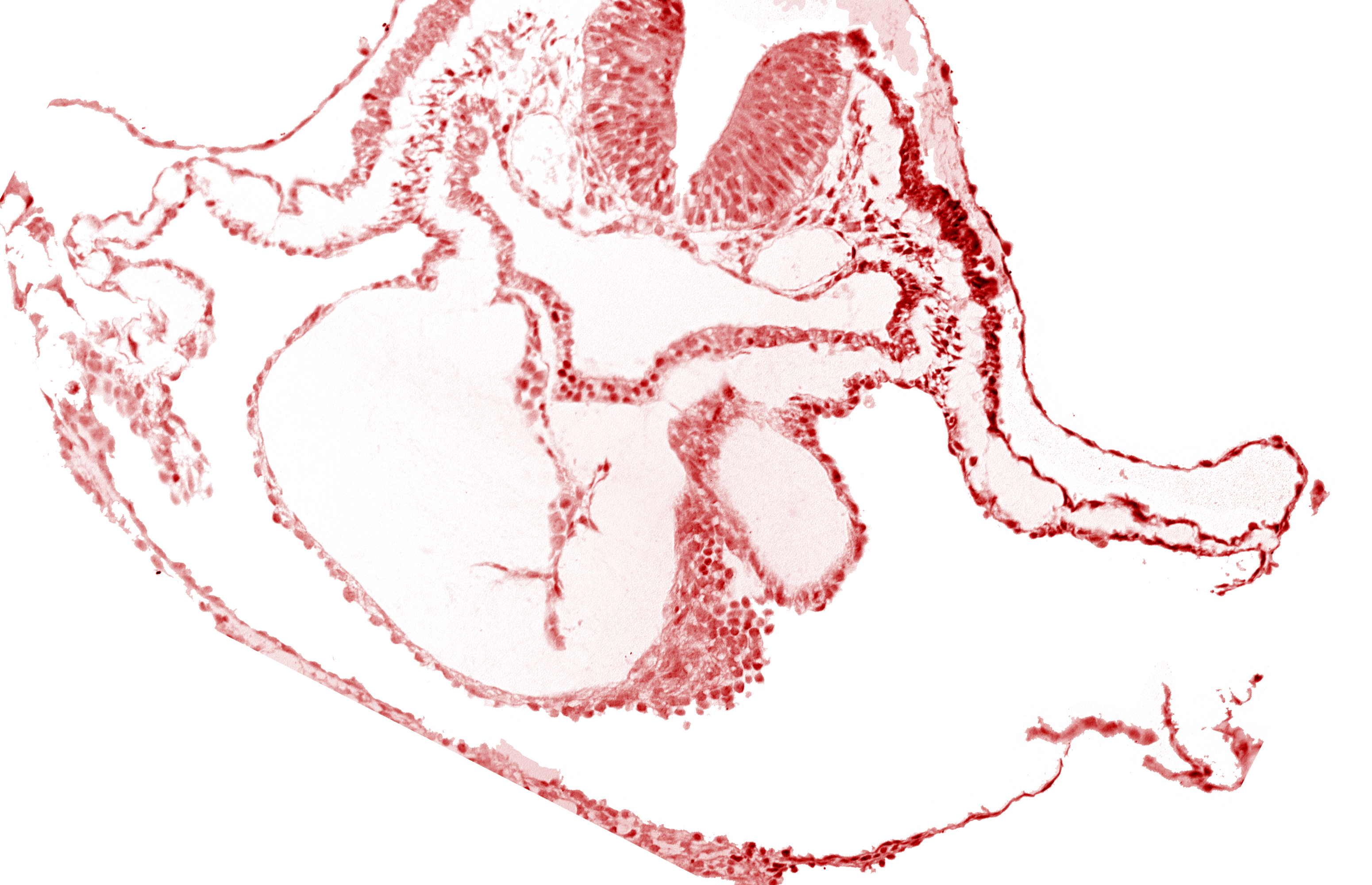 artifact separation(s), bulbis cordis, dorsal aorta, lateral pharyngeal recess, left bulboventricular sulcus, neural fold [rhombencephalon (Rh. B)], notochordal plate, pericardial cavity, presumptive left ventricle, presumptive right ventricle