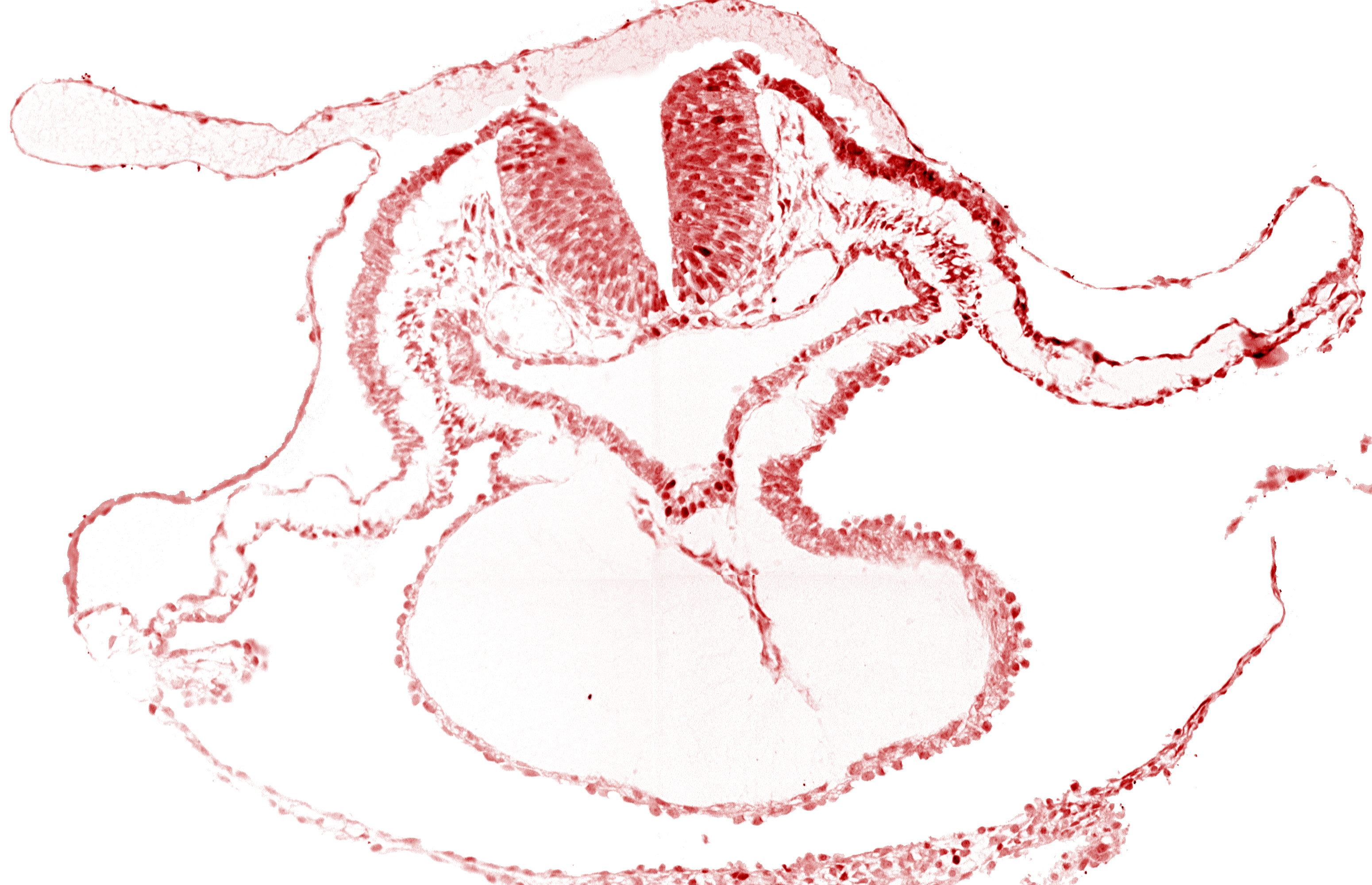 artifact separation(s), cardiac jelly, cephalic neuropore, dorsal aorta, lateral pharyngeal recess, neural fold [rhombencephalon (Rh. B)], pericardial cavity, presumptive left ventricle