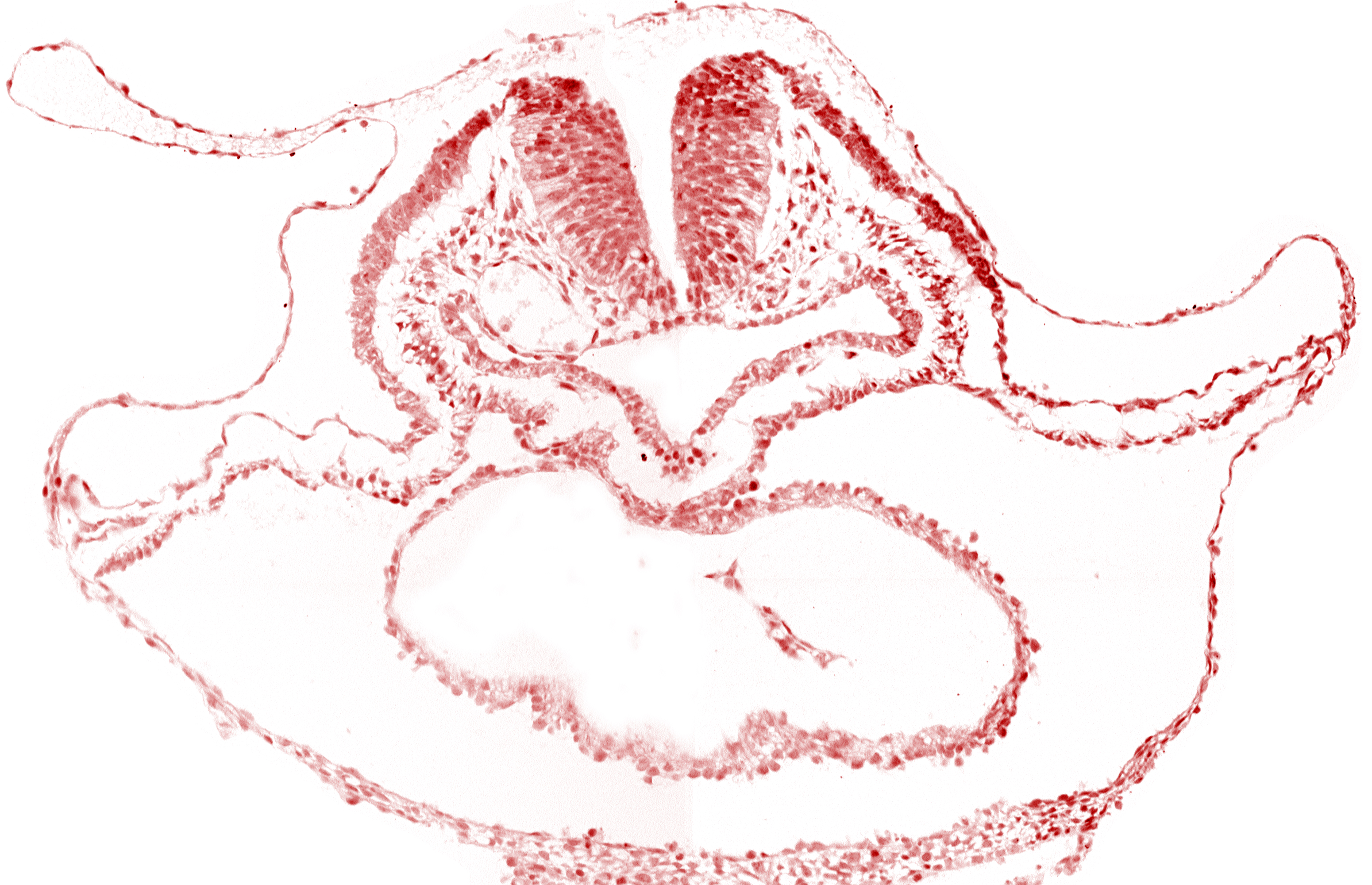cephalic neuropore, dorsal aorta, lateral pharyngeal recess, median pharyngeal groove, neural fold [rhombencephalon (Rh. B)], pericardial cavity, presumptive left ventricle, right bulboventricular sulcus