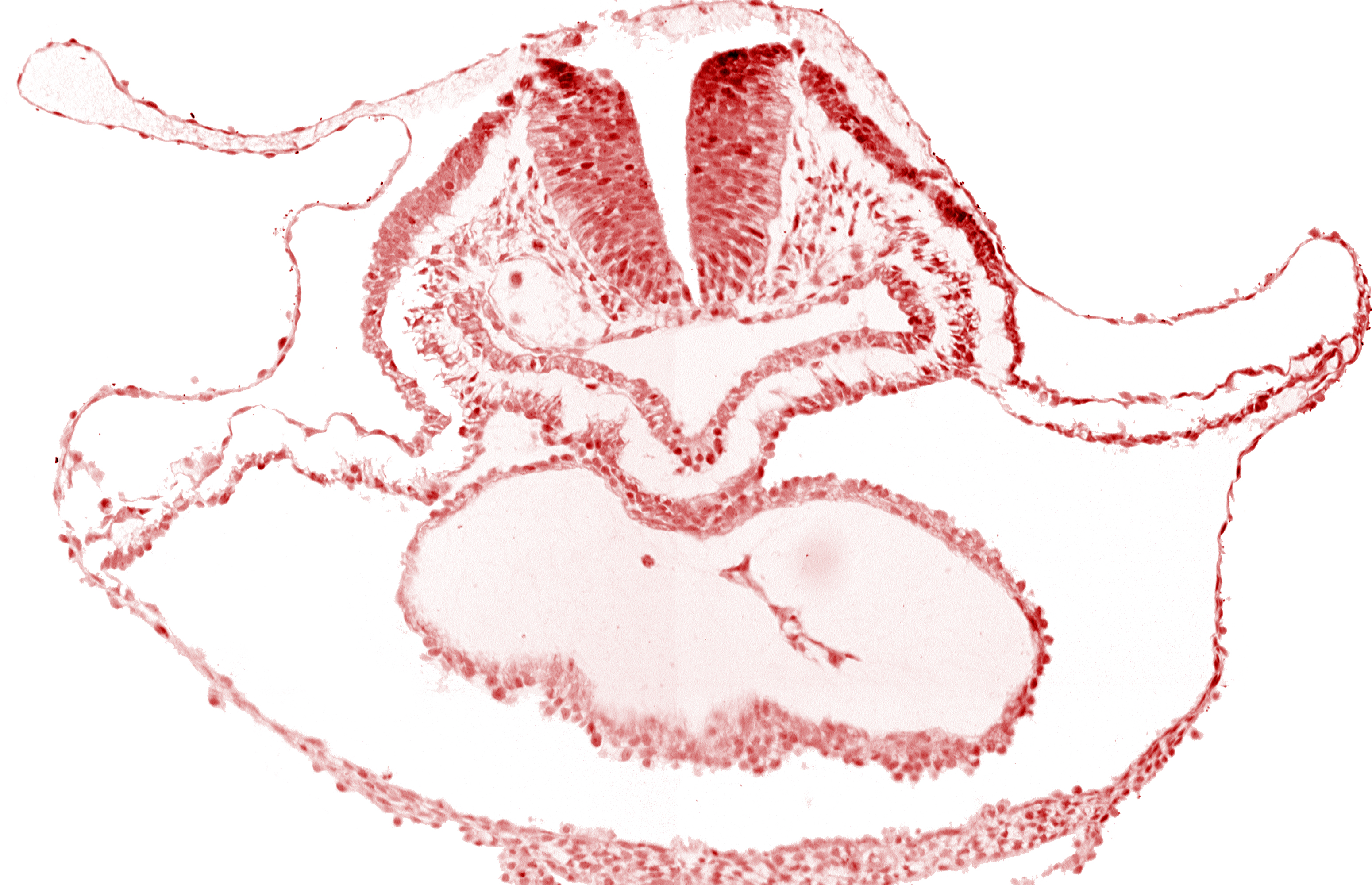 cephalic neuropore, dorsal aorta, lateral pharyngeal recess, median pharyngeal groove, neural fold [rhombencephalon (Rh. B)], pericardial cavity, presumptive left ventricle, right bulboventricular sulcus