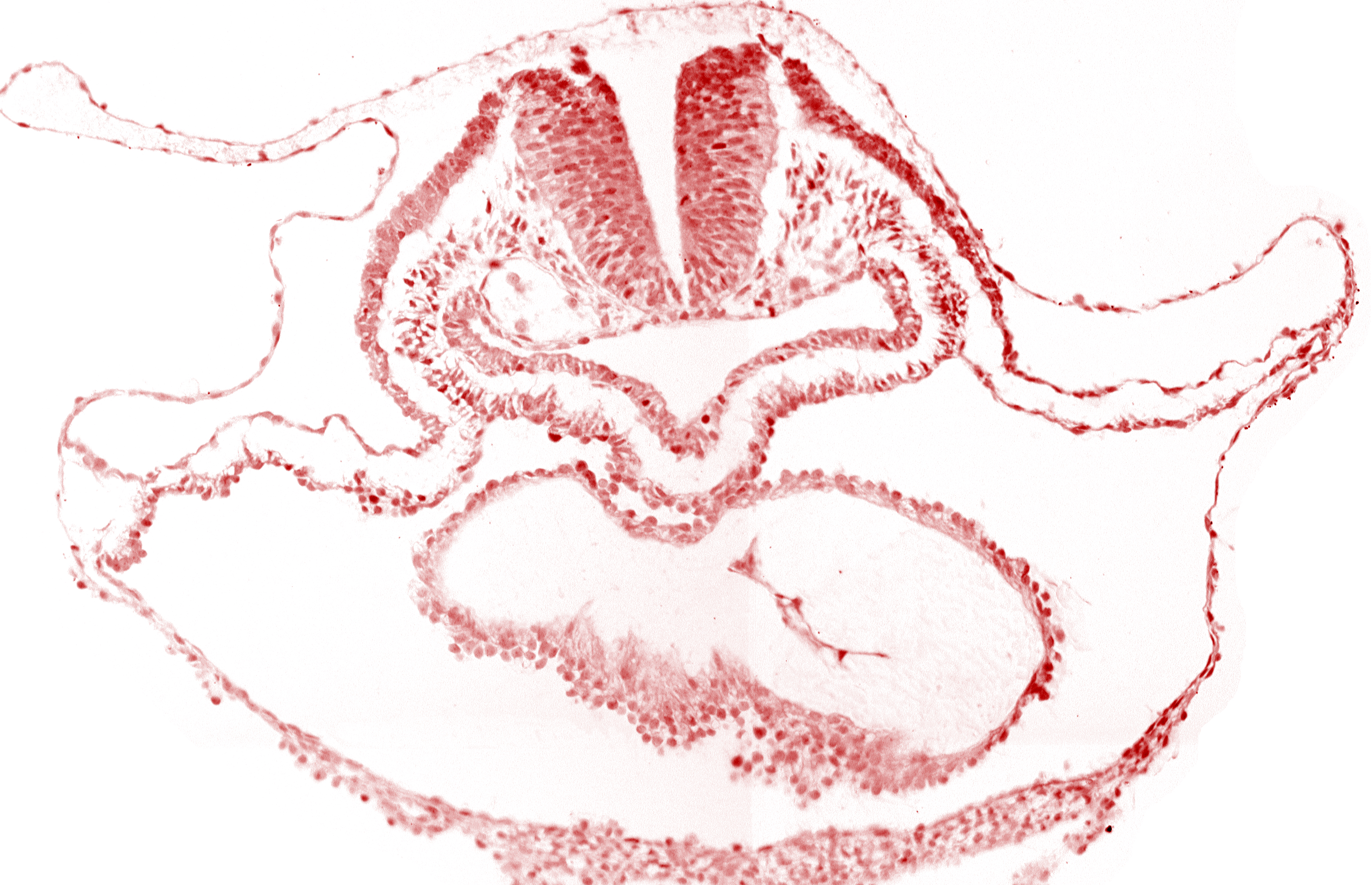 cephalic edge of otic placode, lateral pharyngeal recess, neural fold [rhombencephalon (Rh. B)], pericardial cavity, pericardial sac, presumptive left ventricle