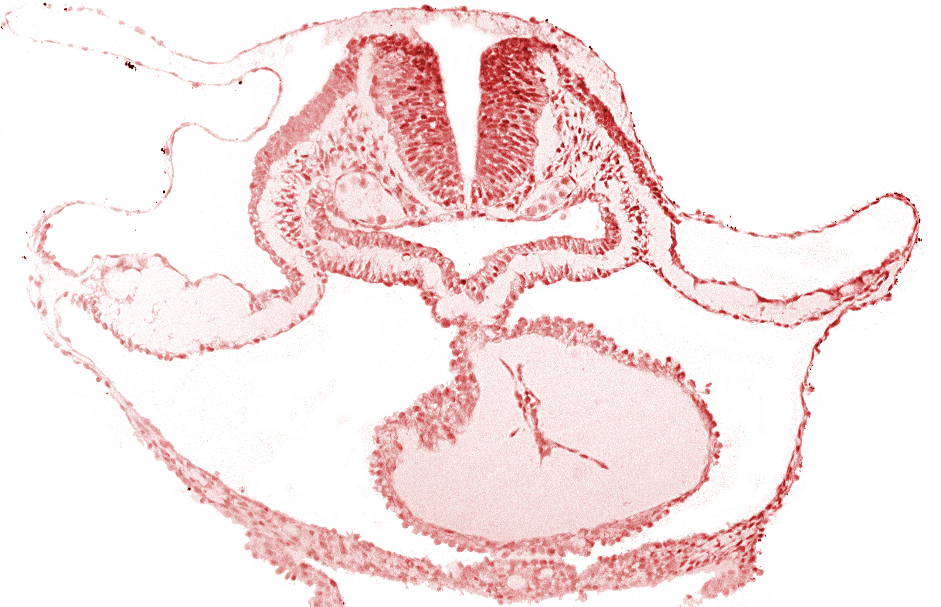 cephalic neuropore, endocardium, epimyocardium, head mesenchyme, laryngotracheal sulcus, lateral pharyngeal recess, mesocardium, neural fold [rhombencephalon (Rh. B)], otic placode, pericardial cavity, presumptive left ventricle