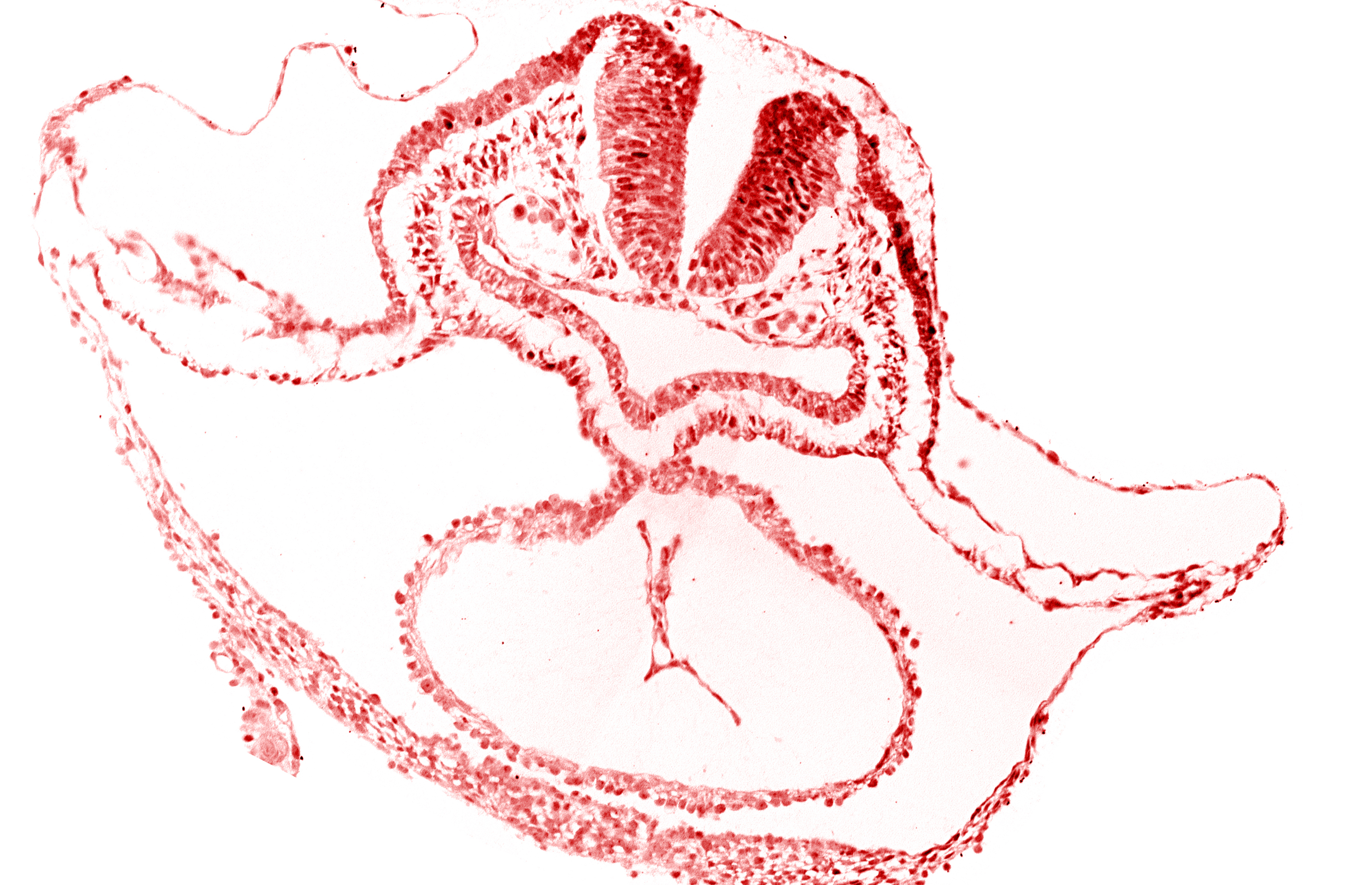 cardiac jelly, epimyocardium, laryngotracheal sulcus, lateral pharyngeal recess, mesocardium, neural fold [rhombencephalon (Rh. B)], otic placode, pericardial cavity, presumptive left ventricle, sulcus limitans