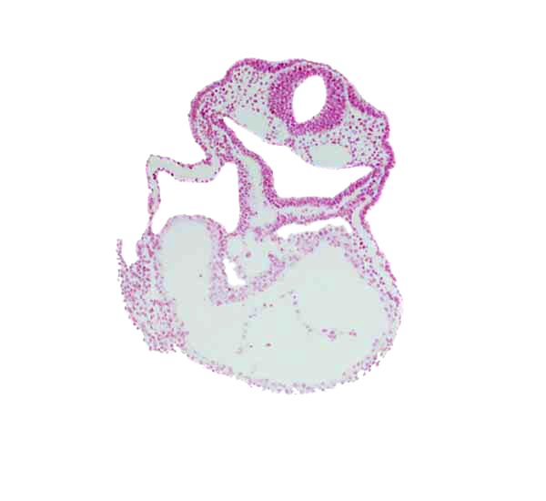 amnion attachment, cardiac jelly, cephalic part of laryngotracheal groove, dorsal aorta, epimyocardium, foregut, head fold region, lateral pharyngeal recess, mesocardium, notochord, otic placode, pericardial cavity, rhombencephalon (Rh. 5)