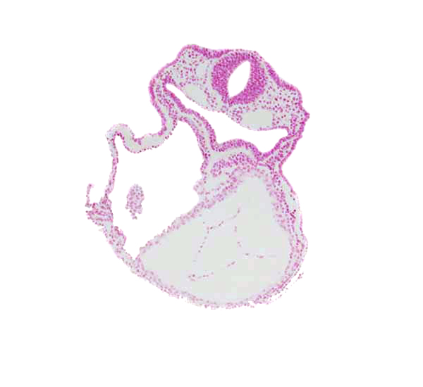 amnion attachment, caudal edge of right ventricle, cephalic edge of atrioventricular canal, dorsal aorta, foregut, laryngotracheal groove, lateral pharyngeal recess, left ventricle, mesocardium, otic placode, rhombencephalon (Rh. 5)