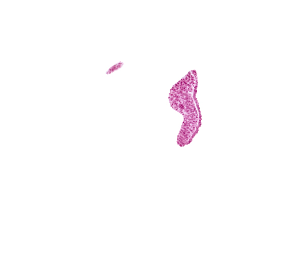 cephalic neuropore, neural fold [diencephalon (D1)], neural fold [diencephalon (D2)], optic sulcus, surface ectoderm, tangentially cut surface ectoderm (right side)