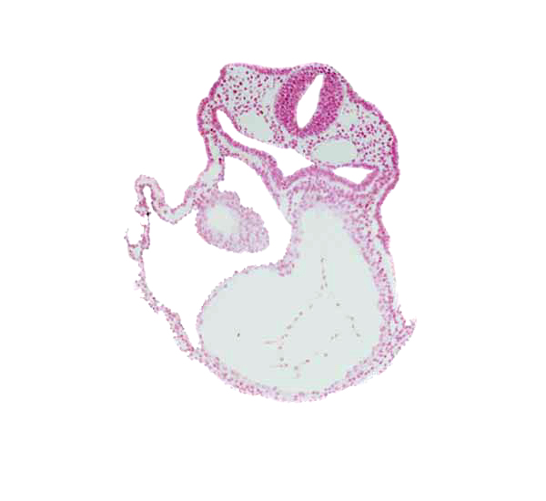 caudal edge of otic placode, cephalic part of right atrium, dorsal aorta, edge of atrioventricular canal, head mesenchyme, lateral pharyngeal recess, left ventricle, notochord, pericardial cavity, primary head vein, respiratory primordium