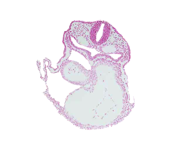 cardiac jelly, dorsal aorta, edge of atrioventricular canal, foregut, glossopharyngeal neural crest (CN IX), head mesenchyme, left ventricle, pericardial cavity, precardinal vein, respiratory primordium, rhombencephalon (Rh. 6), right atrium