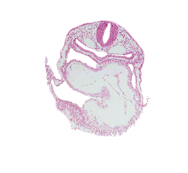 amnion attachment, atrioventricular junction, caudal part of left ventricle, endoderm, foregut, head mesenchyme, lateral pharyngeal recess, left atrium, pericardial cavity, precardinal vein, rhombencephalon (Rh. 7), right atrium, surface ectoderm