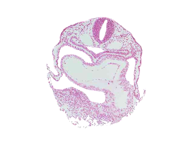 amnion attachment, cardiac jelly, dorsal aorta, epimyocardium, foregut lumen, interatrial foramen (primum), left atrium, pericardial cavity, precardinal vein, right atrium, septum transversum, umbilical vesicle wall