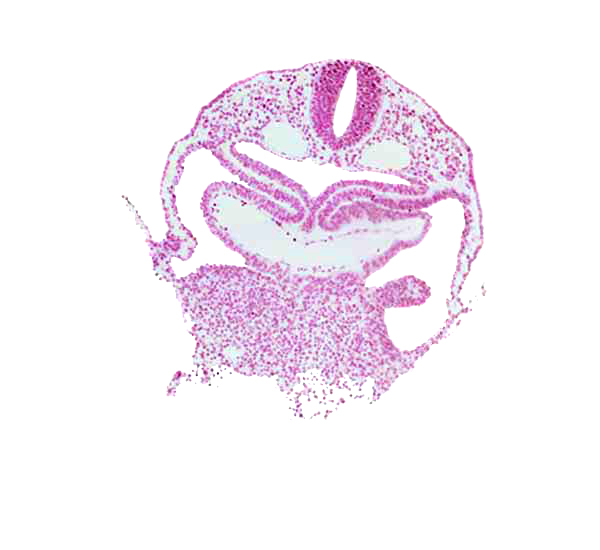 amnion attachment, caudal part of interatrial foramen (primum), cephalic edge of hepatic plate, dorsal aorta, left atrium, neural tube, notochordal plate, pericardial cavity, precardinal vein, right atrium, septum transversum