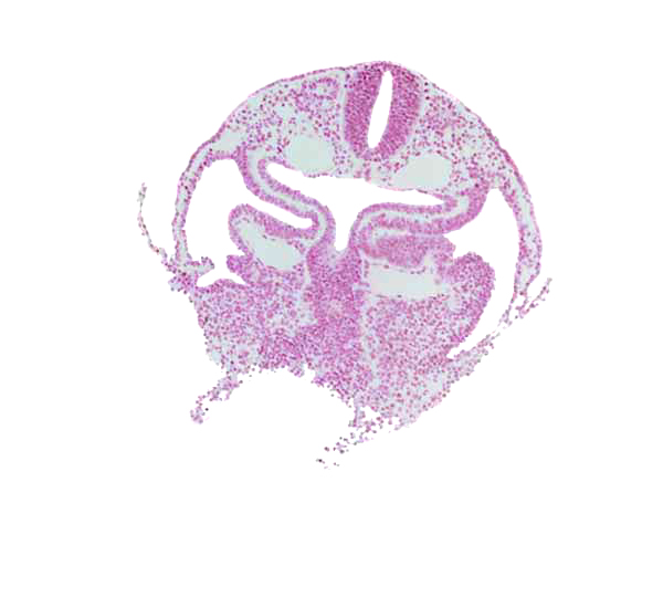 caudal part of foregut, cephalic part of pericardioperitoneal canal (pleural cavity), course of common cardinal vein, dermatomyotome 1 (O-1), endoderm, hepatic plate, hypoglossal neural crest (CN XII), left horn of sinus venosus, neural tube, pericardial cavity, primordial hepatic antrum, rhombencephalon (Rh. D), right horn of sinus venosus, sclerotome, septum transversum, umbilical vesicle wall