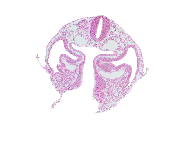 amnion attachment, cephalic intestinal portal, dermatomyotome 1-2 intersegmental region, dorsal aorta, junction of foregut and midgut, left horn of sinus venosus, notochordal plate, pericardioperitoneal canal (pleural cavity), postcardinal vein, rhombencephalon (Rh. D), right horn of sinus venosus, septum transversum, umbilical vesicle stalk lumen, umbilical vesicle wall