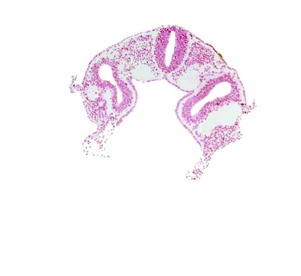 amnion attachment, dermatomyotome 2 (O-2) , dorsal aorta, hypoglossal neural crest (CN XII), left horn of sinus venosus, midgut, peritoneal cavity (coelom), postcardinal vein, rhombencephalon (Rh. D), sclerotome, somatopleure, splanchnopleure