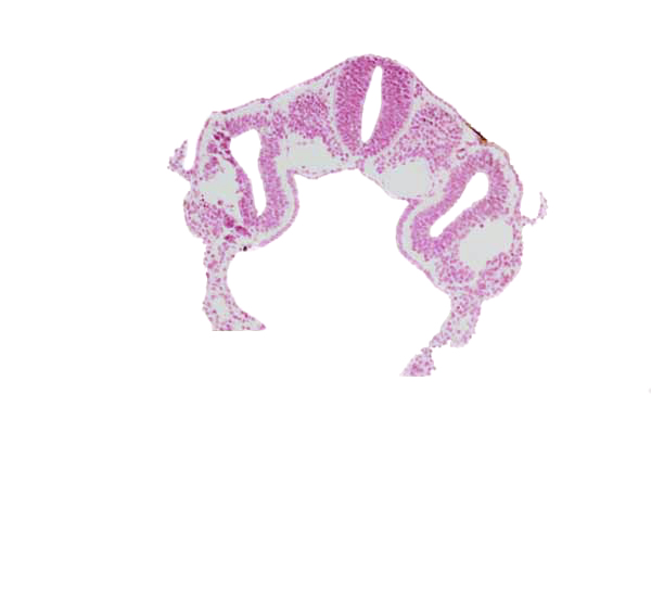 dermatomyotome 3 (O-3) , dorsal aorta, hypoglossal neural crest (CN XII), left horn of sinus venosus, midgut, neural tube, peritoneal cavity (coelom), postcardinal vein, rhombencephalon (Rh. D)