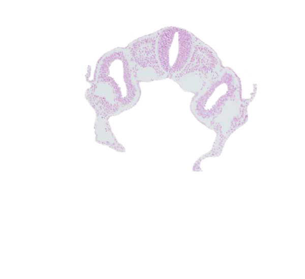 amniotic cavity, dermatomyotome 3 (O-3) , dorsal aorta, left horn of sinus venosus, midgut, postcardinal vein, right horn of sinus venosus, umbilical vesicle cavity