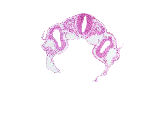 dermatomyotome 3 (O-3) , hypoglossal neural crest (CN XII), junction of left horn of sinus venosus and left vitelline (omphalomesenteric) vein, left horn of sinus venosus, midgut, peritoneal cavity (coelom), postcardinal vein, rhombencephalon (Rh. D), right horn of sinus venosus, right vitelline (omphalomesenteric) vein, somitocoel 3